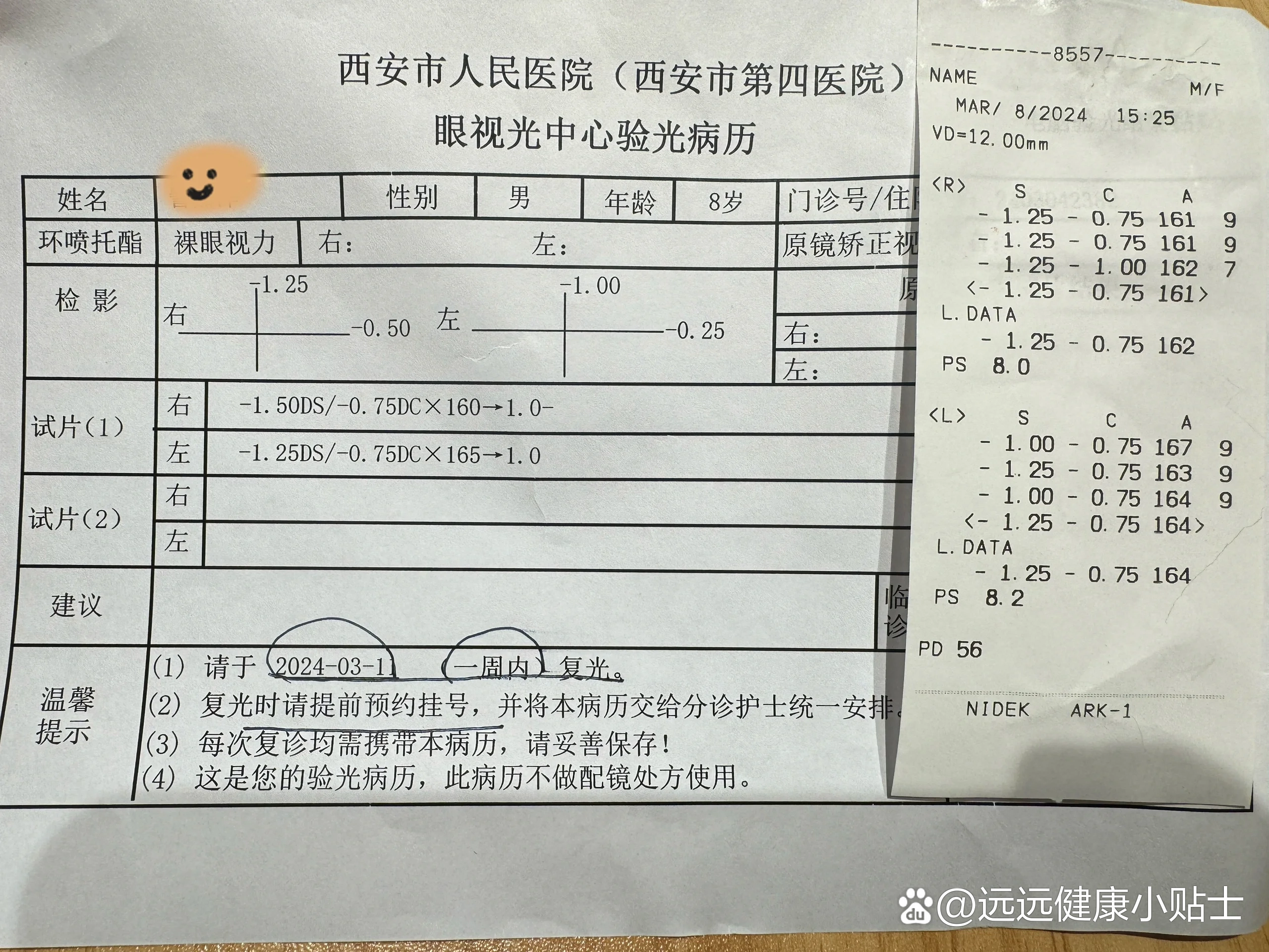 西安第四医院眼科娃放寒假之前视力还是好好的,前两天体检出来