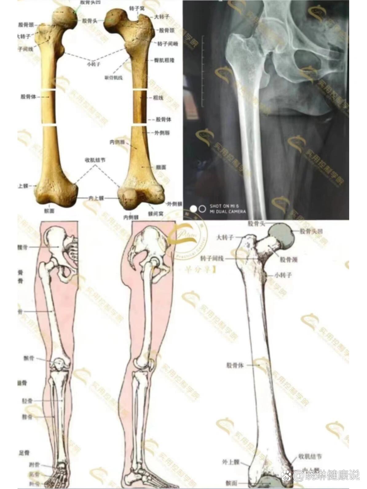 小知识分享之股骨