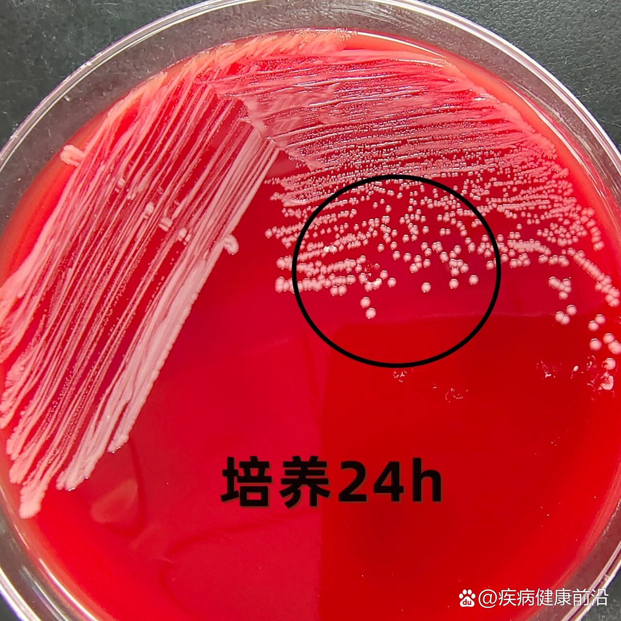 卡他莫拉菌手绘图图片