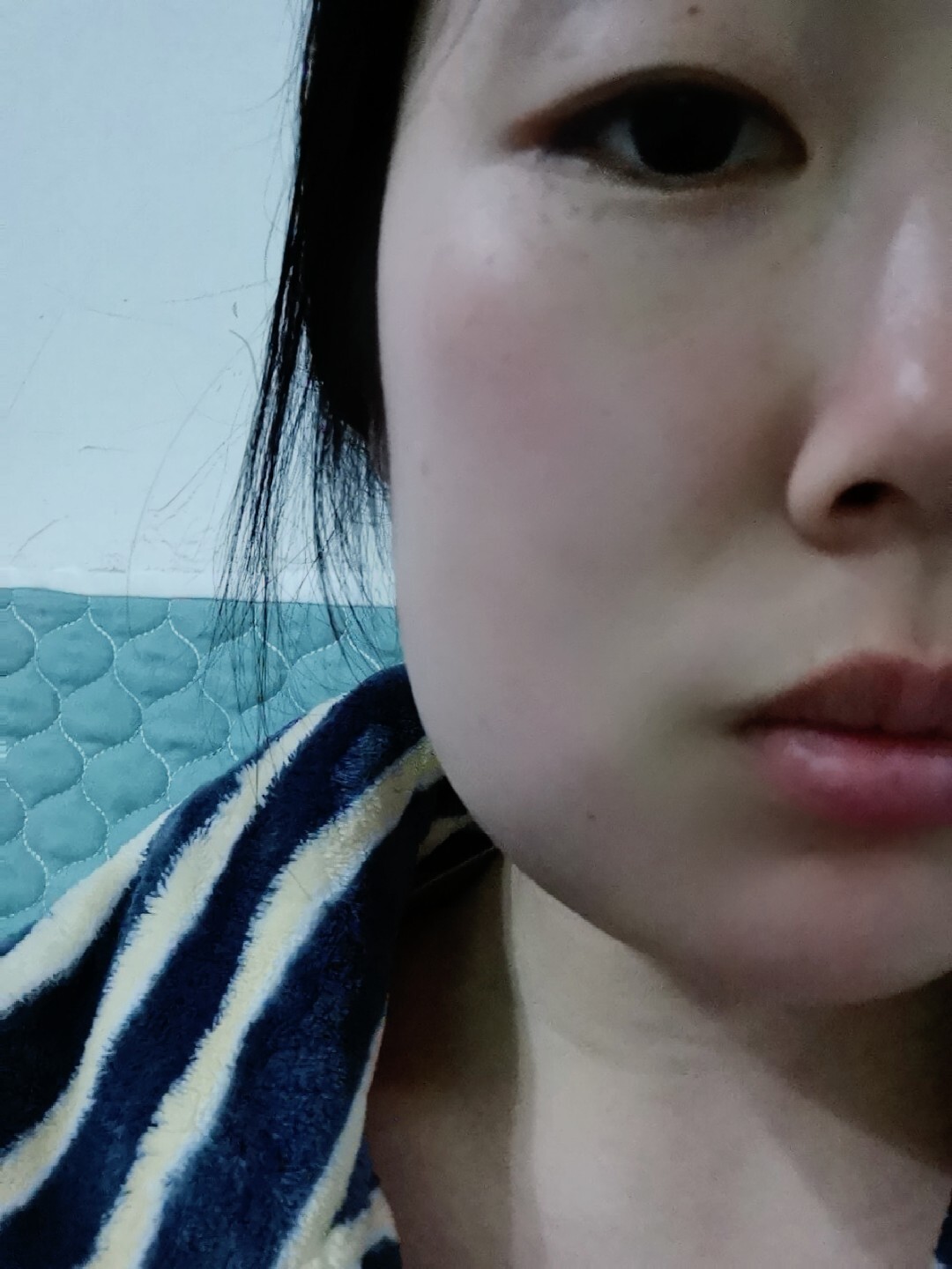 拔完智齿的第三天