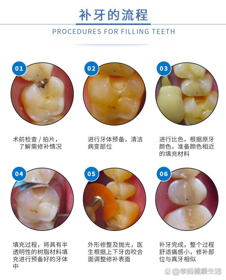 牙釉质缺损图片