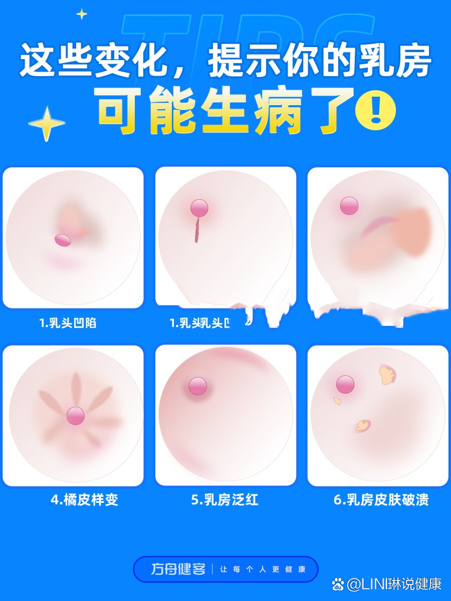 乳房橘子皮是什么样子图片