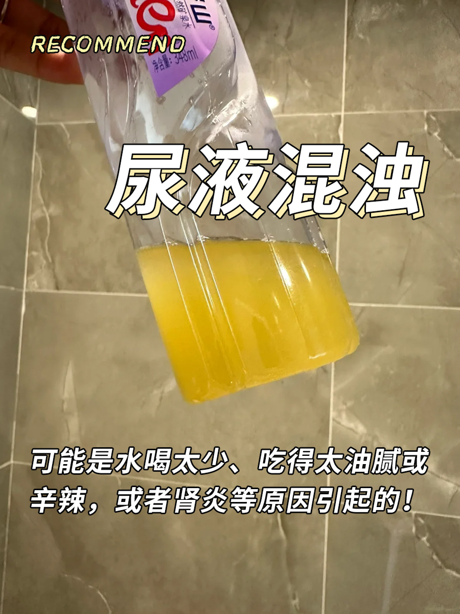 尿液混浊别轻视,可能是这些原因!