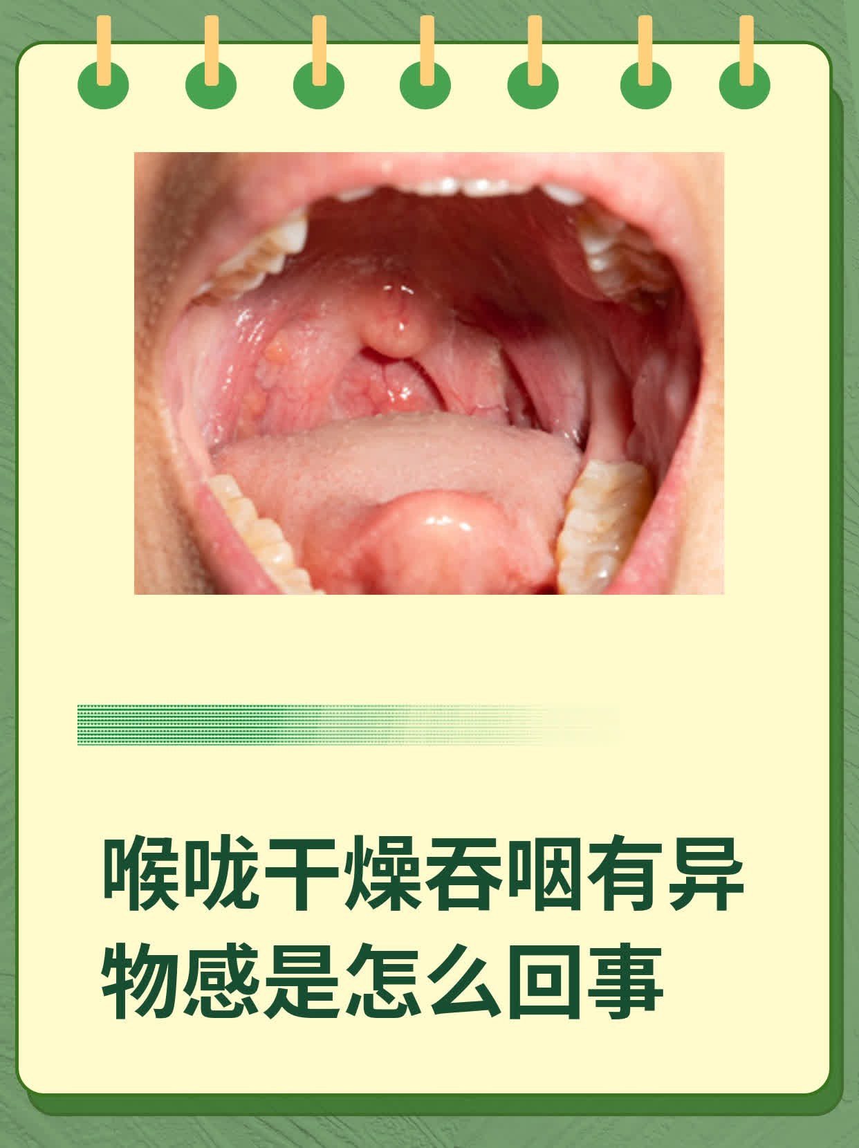 嗓子干涩怎么回事图片