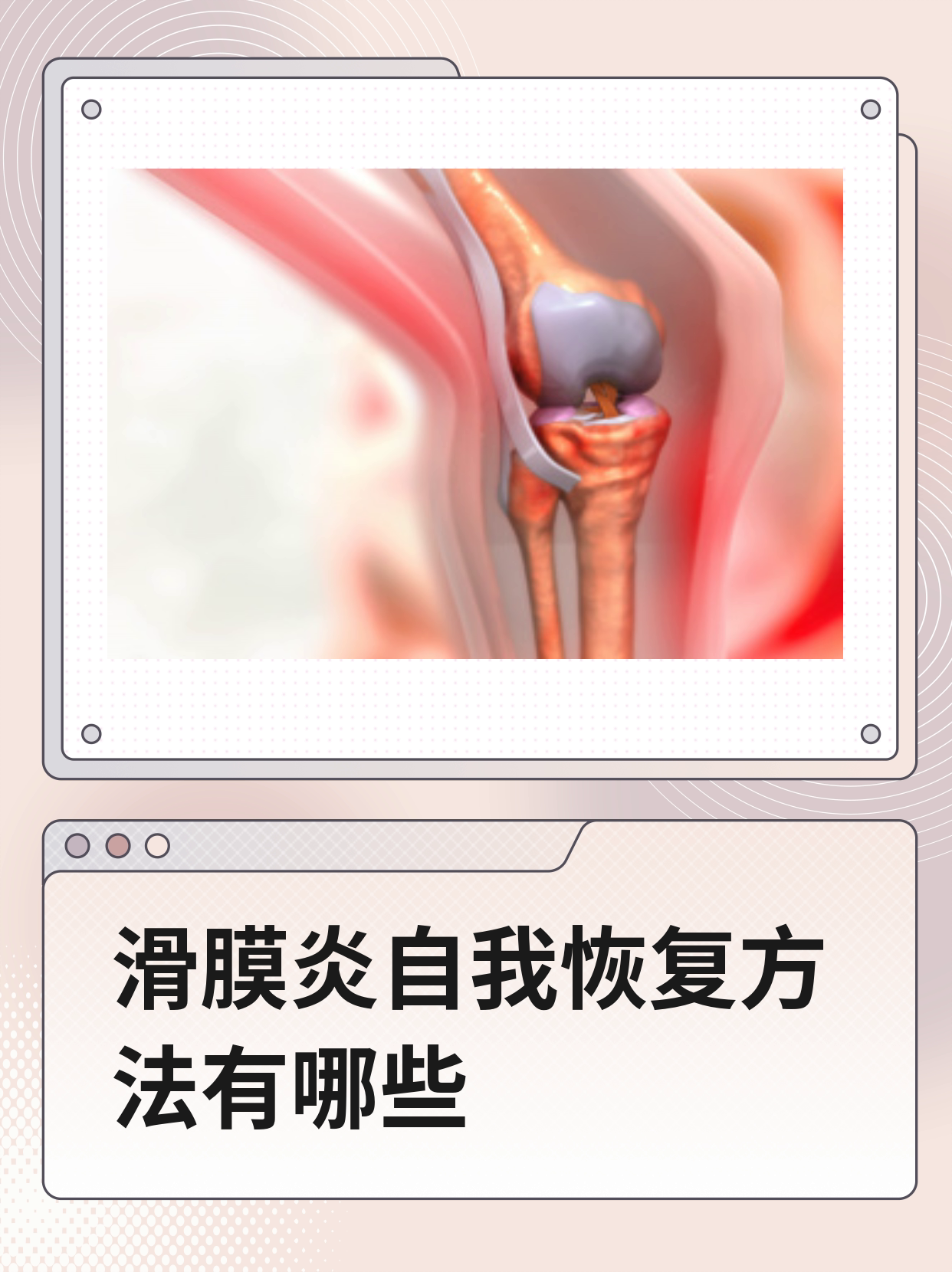 包含原空军总医院代挂专家号加代问诊康复训练专业指导，恢复效果更佳的词条