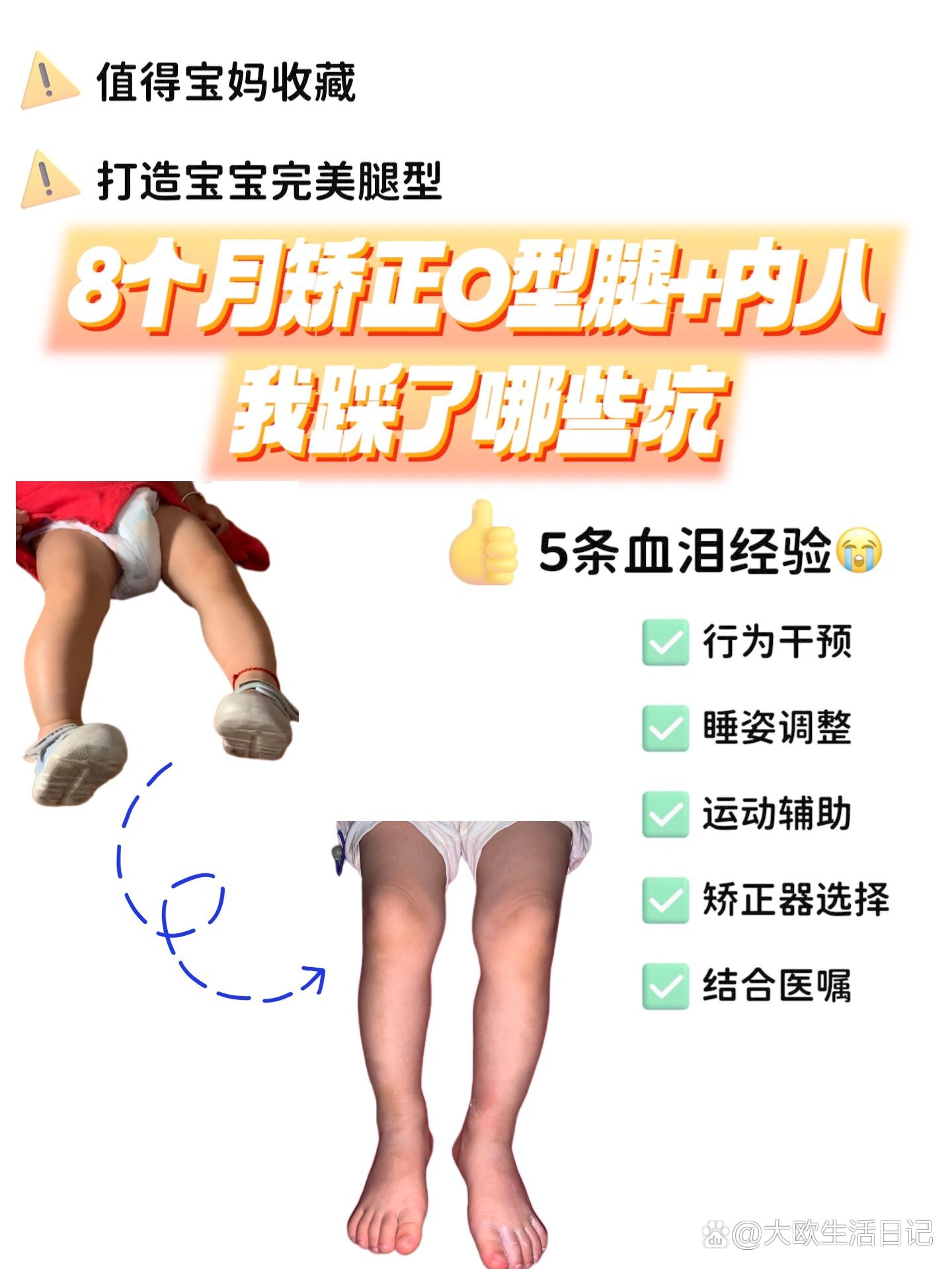 8个月矫正宝宝o型腿 内八,我踩了这些坑01