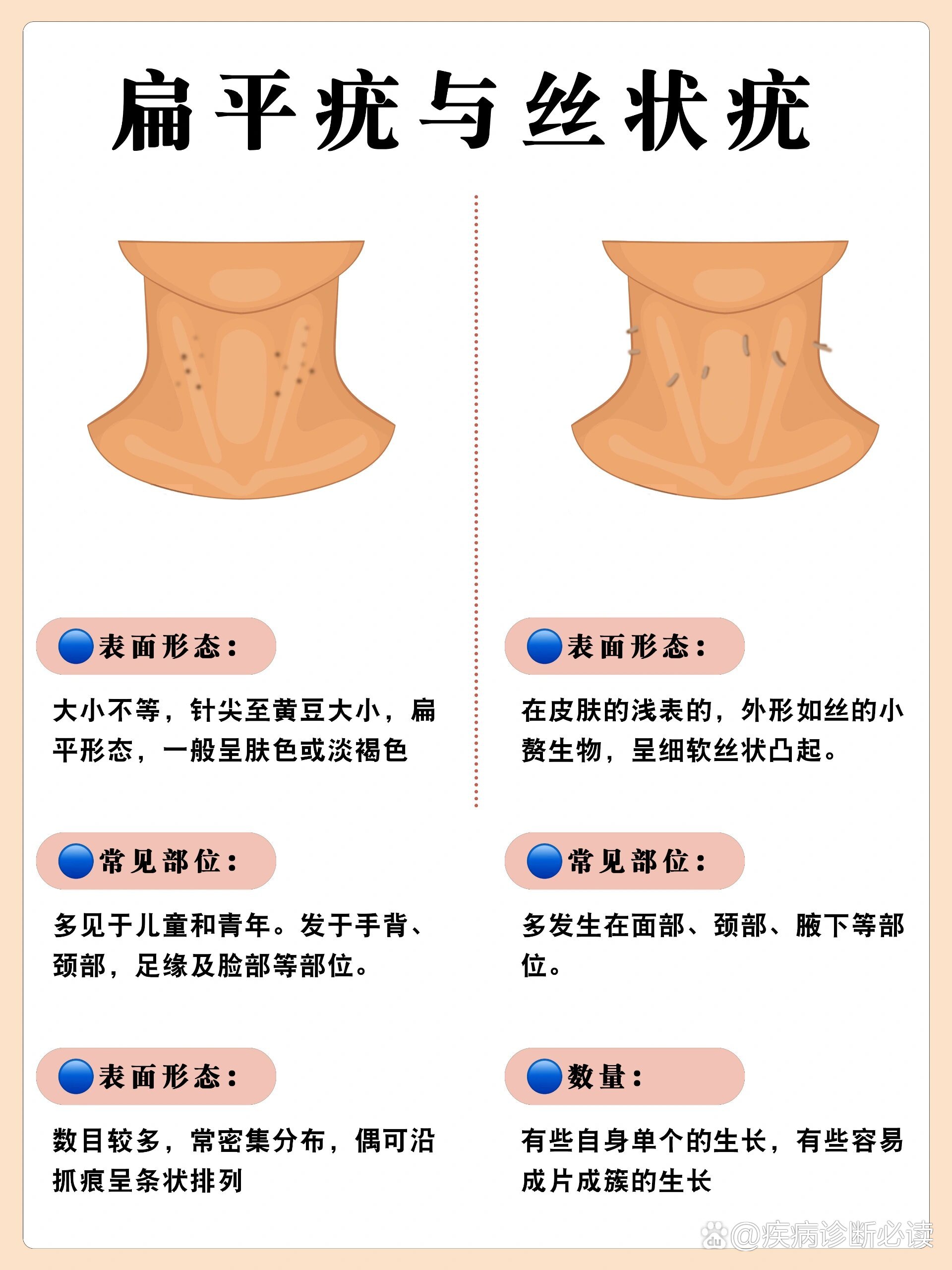 扁平疣怎么去除方法图片