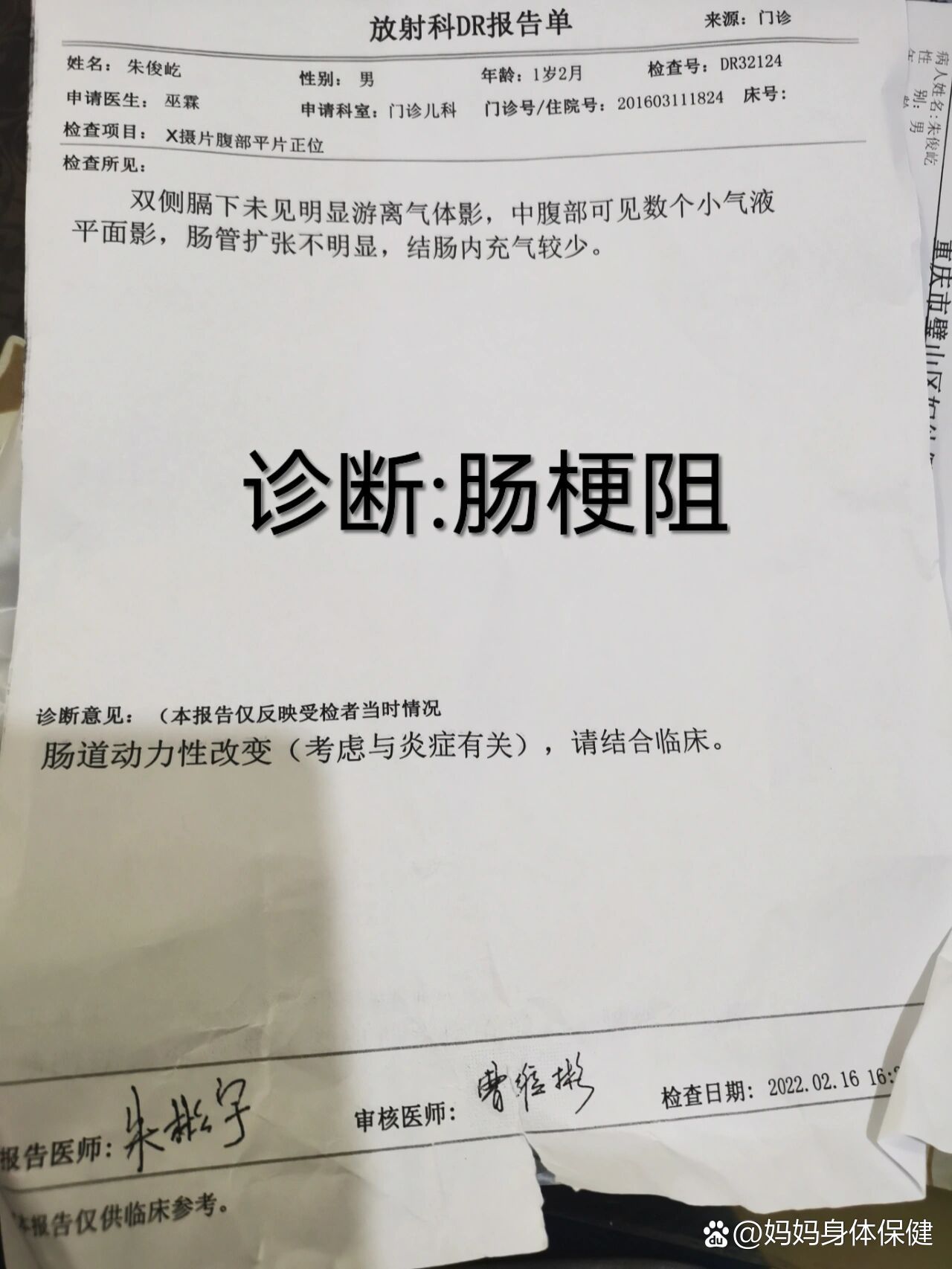 肠梗阻x线报告图片