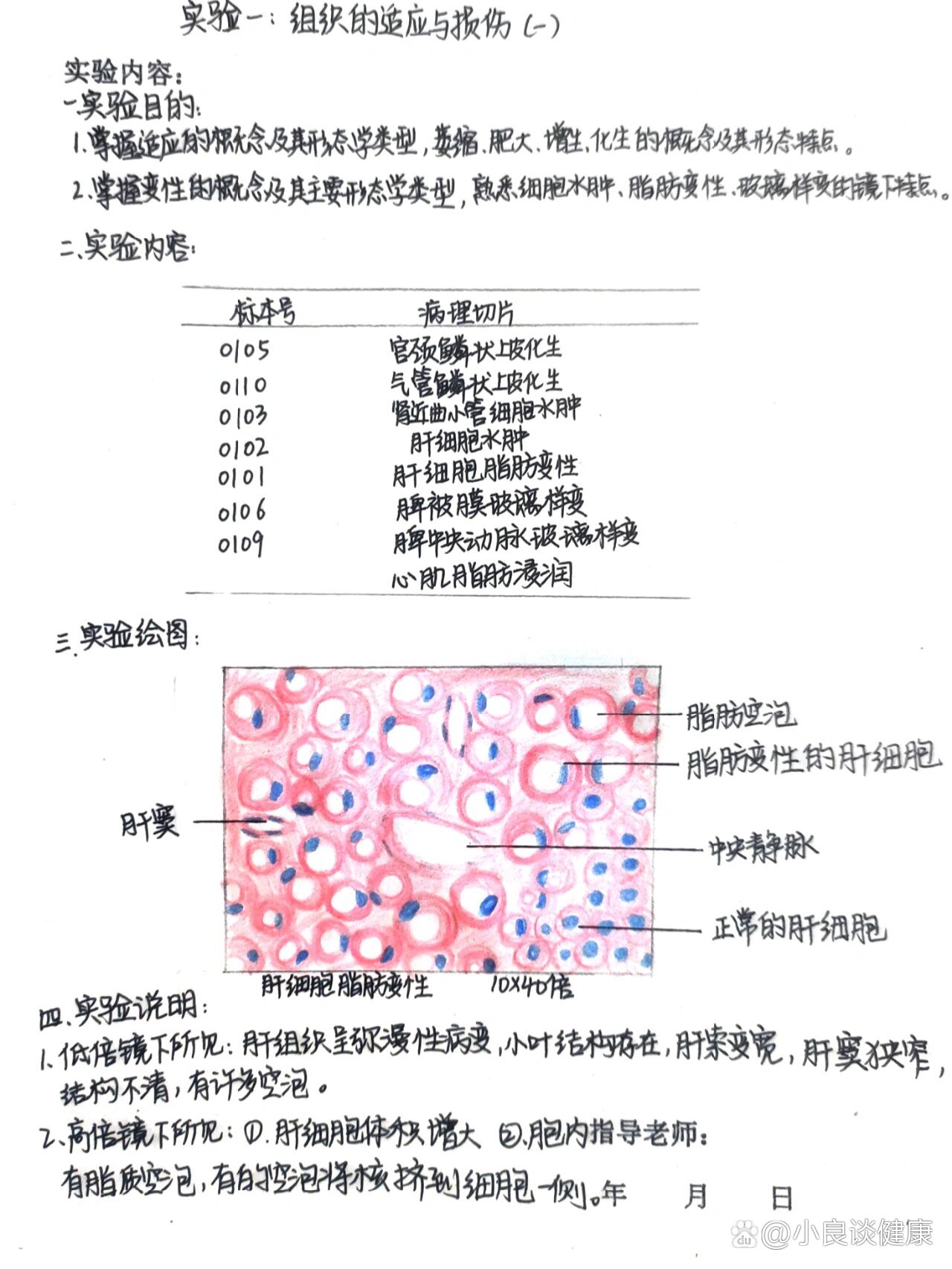 病理实验报告~肝脂肪变性