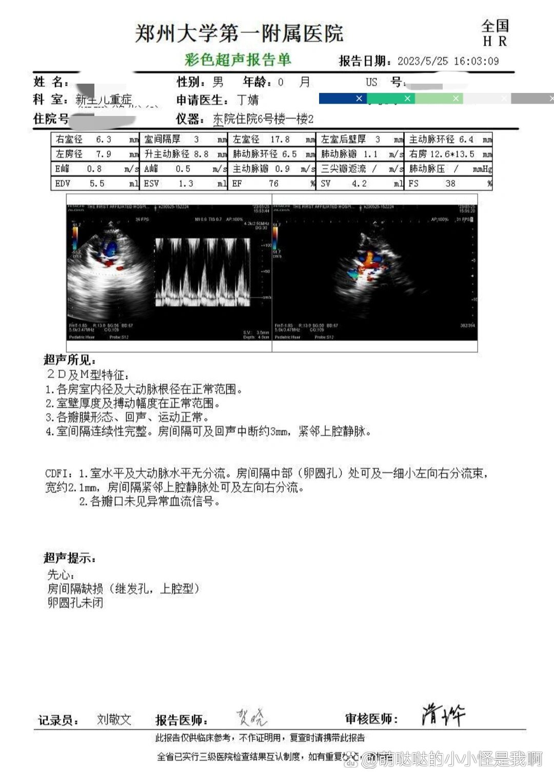 新生儿房间隔缺损4mm图片