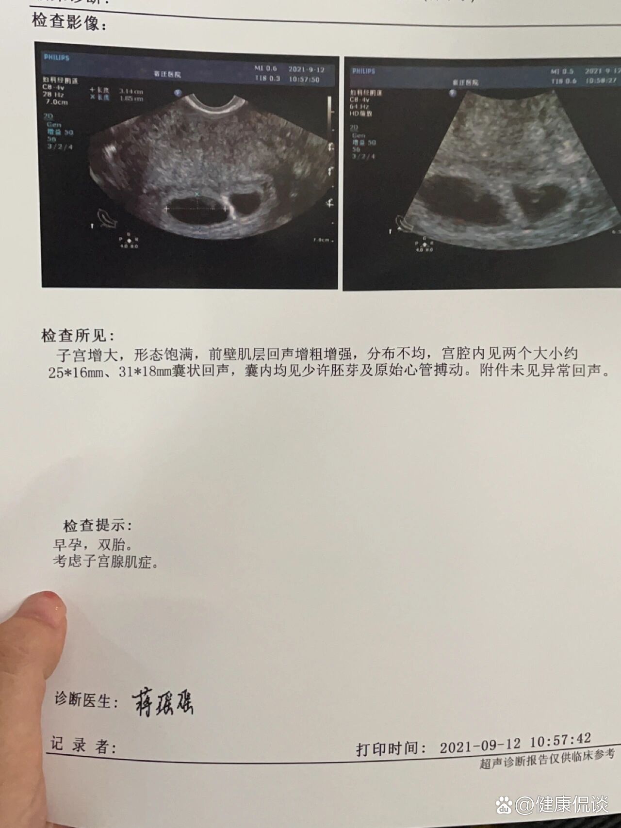 怀孕6周孕囊大小图片