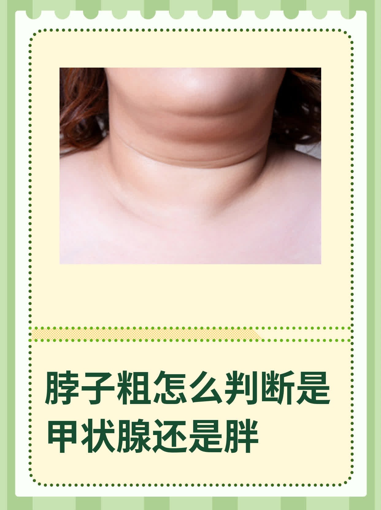 脖子粗怎么判断是甲状腺还是胖