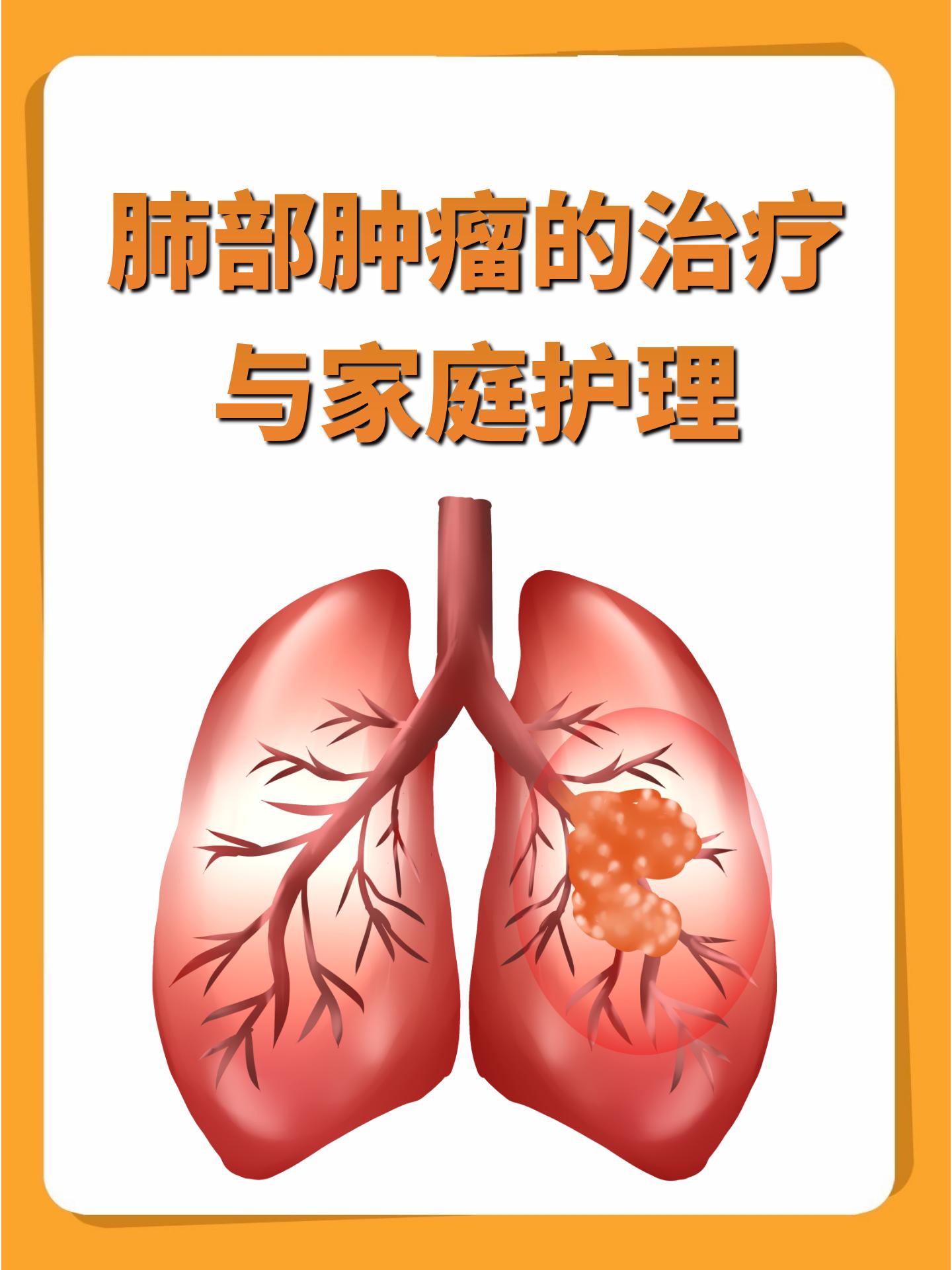 肺部肿瘤的治疗与家庭护理