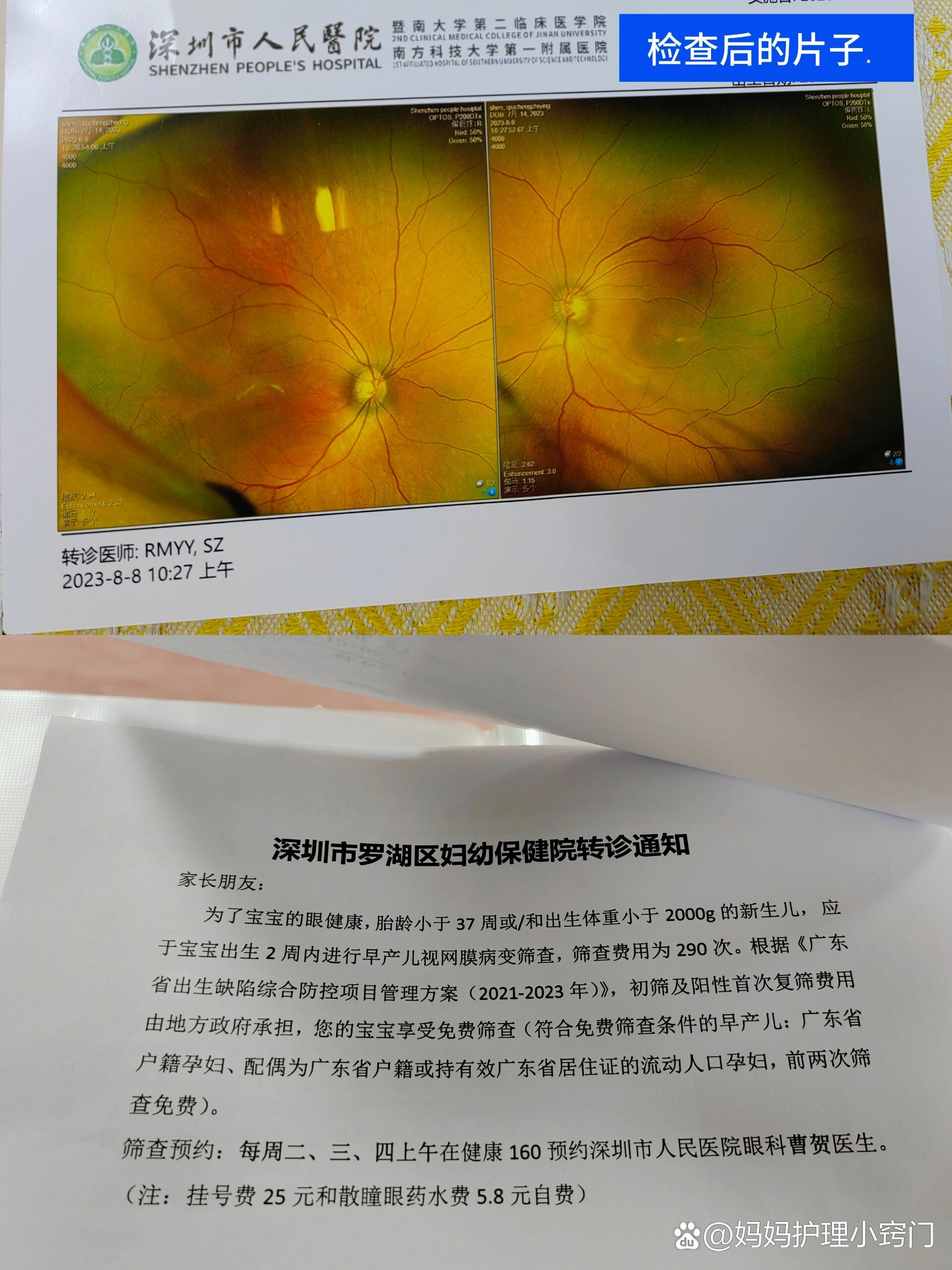 早产儿:孩子如何做眼底筛查?