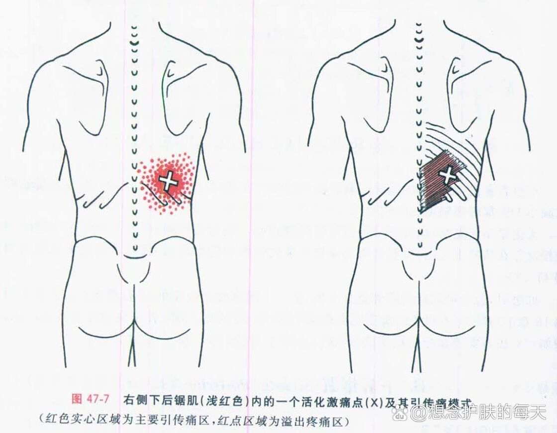 下后锯肌起止点图片