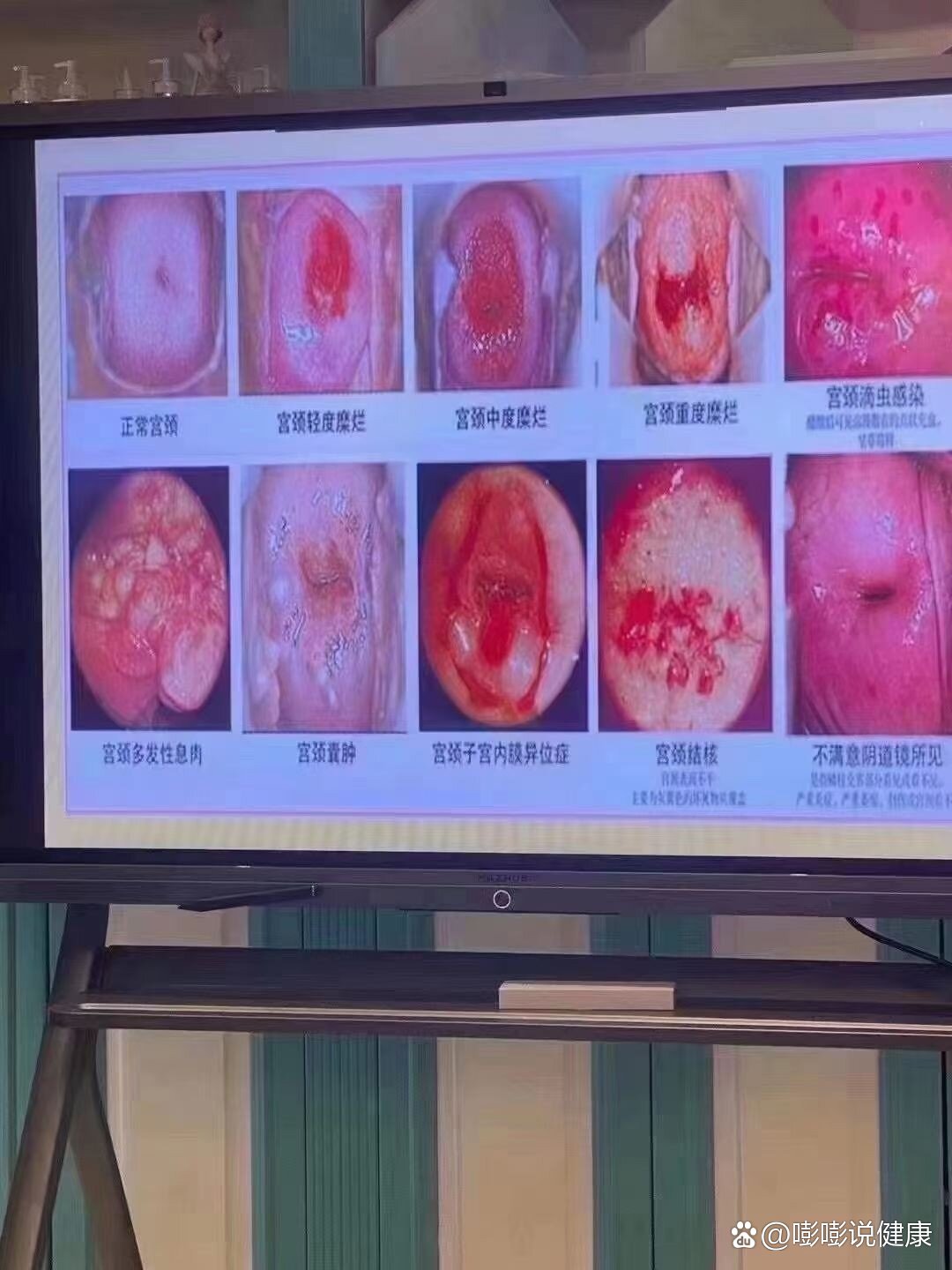 1080_1440竖版 竖屏gif 动态图 动图
