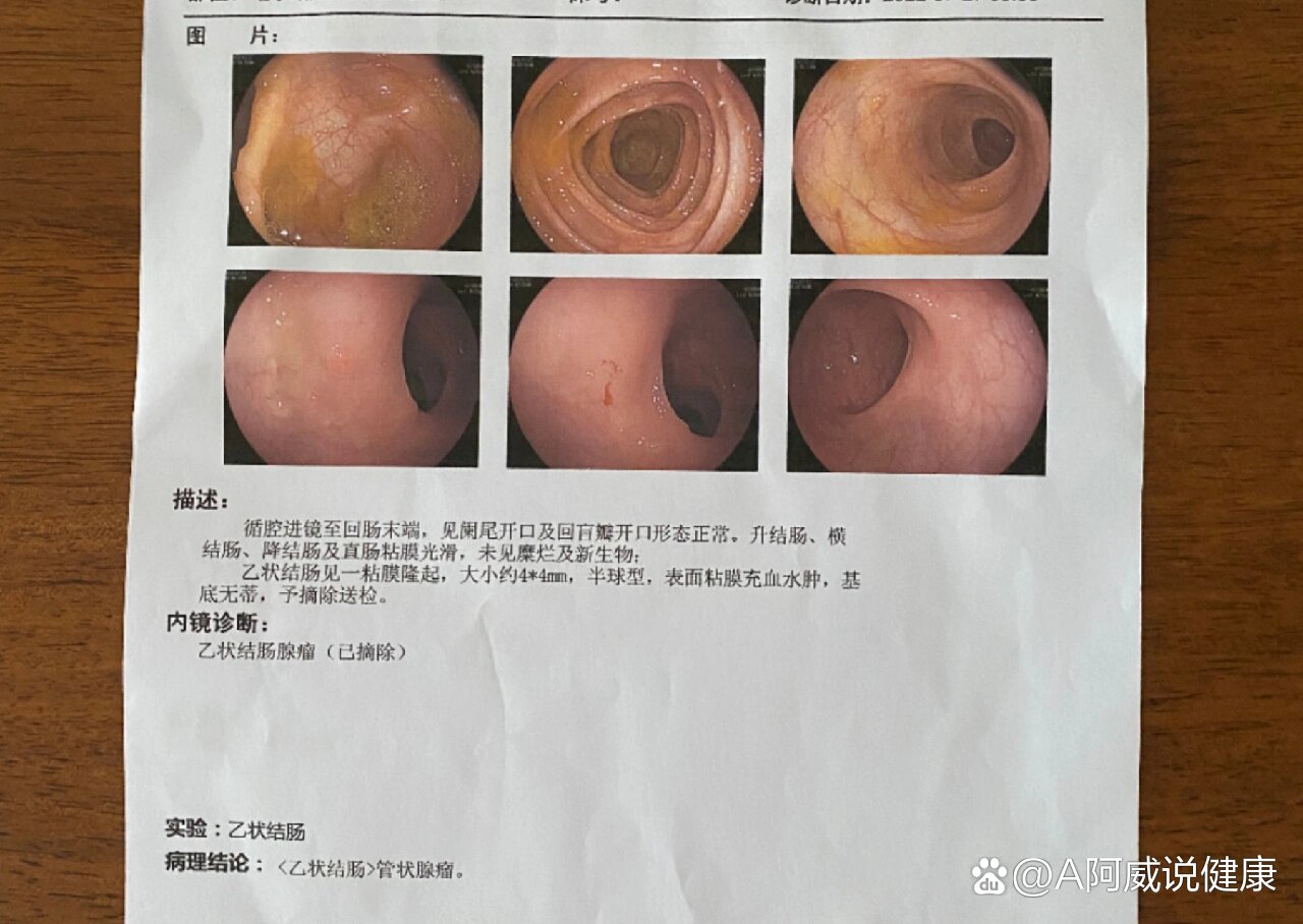 胃镜能看到咽喉吗图片