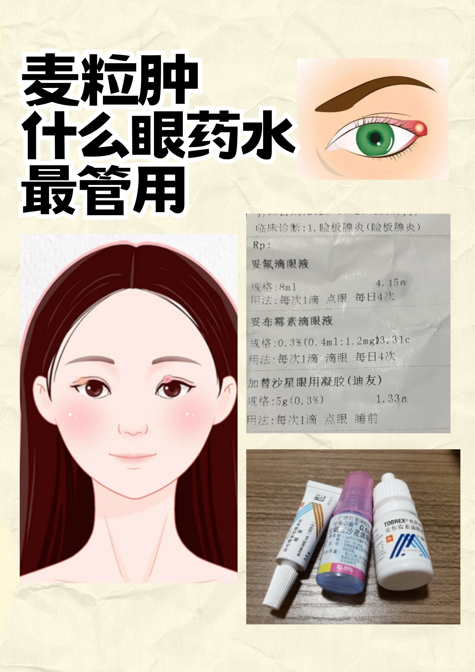 医生建议使用抗生素眼药水缓解,选择了诺氟沙星滴眼液,一次1-2滴,一日