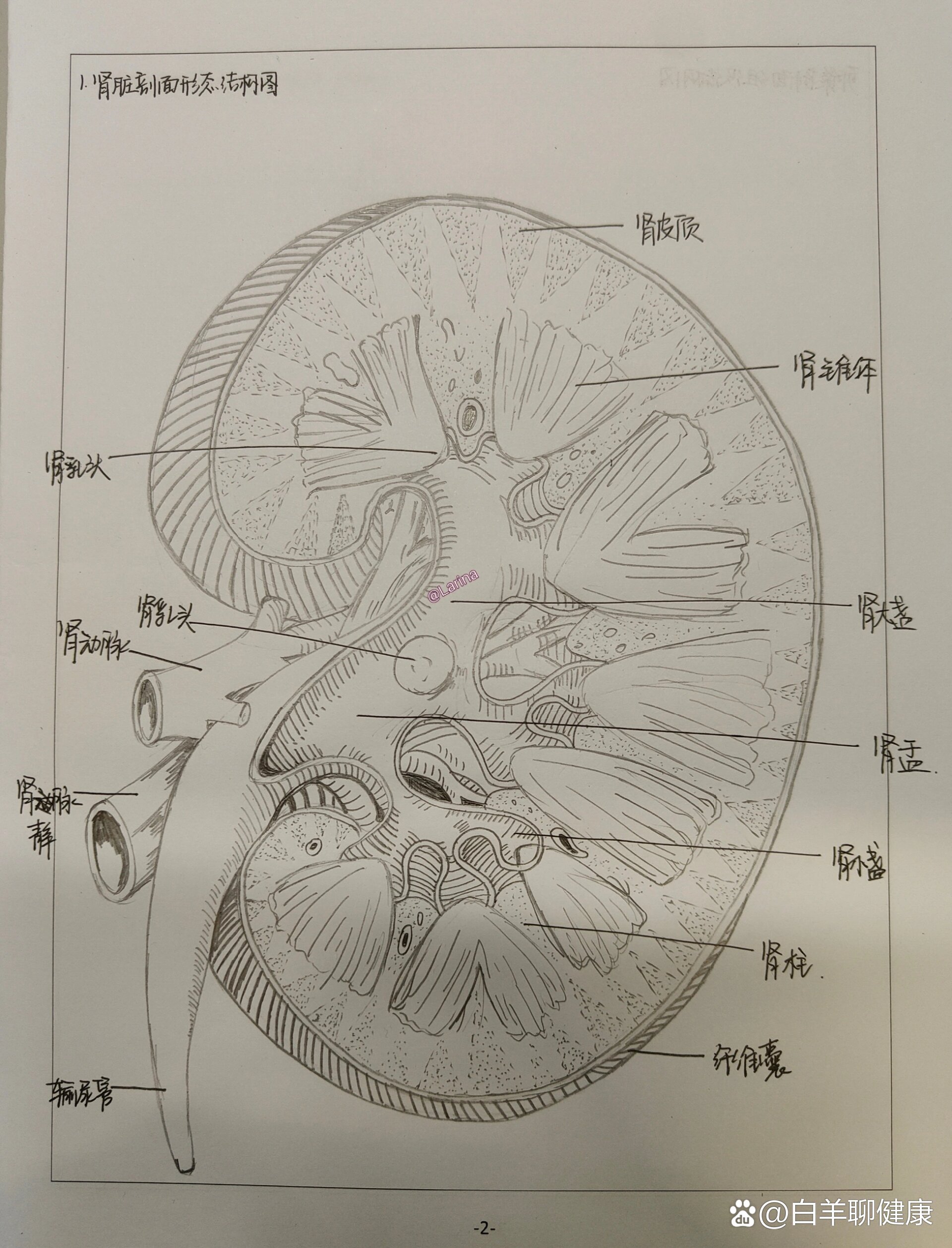 肾结核手绘图图片