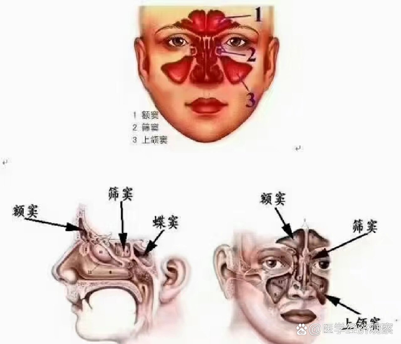 咱们的鼻腔里有4对8个鼻窦,从上到下分别是额窦,筛窦,上颌窦,蝶窦.