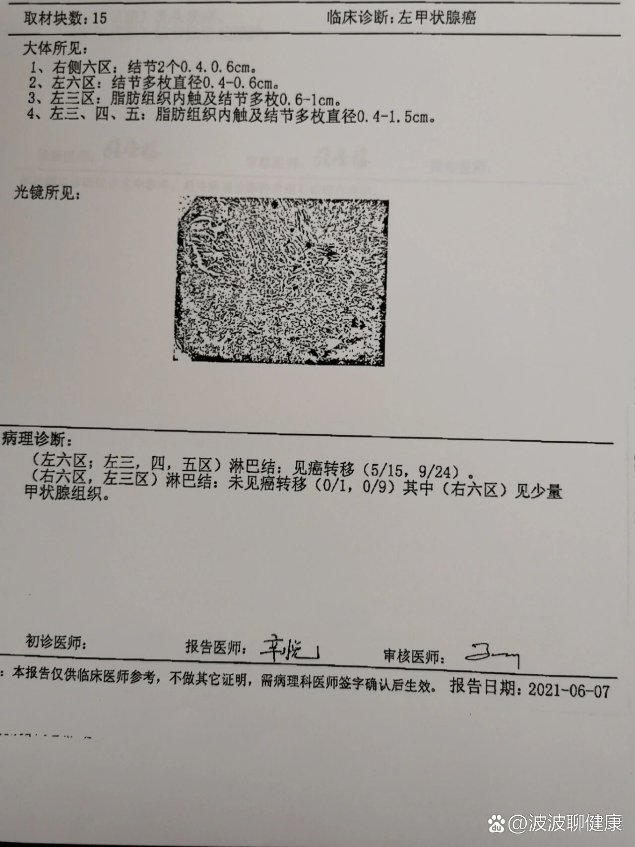 甲癌淋巴转移14个