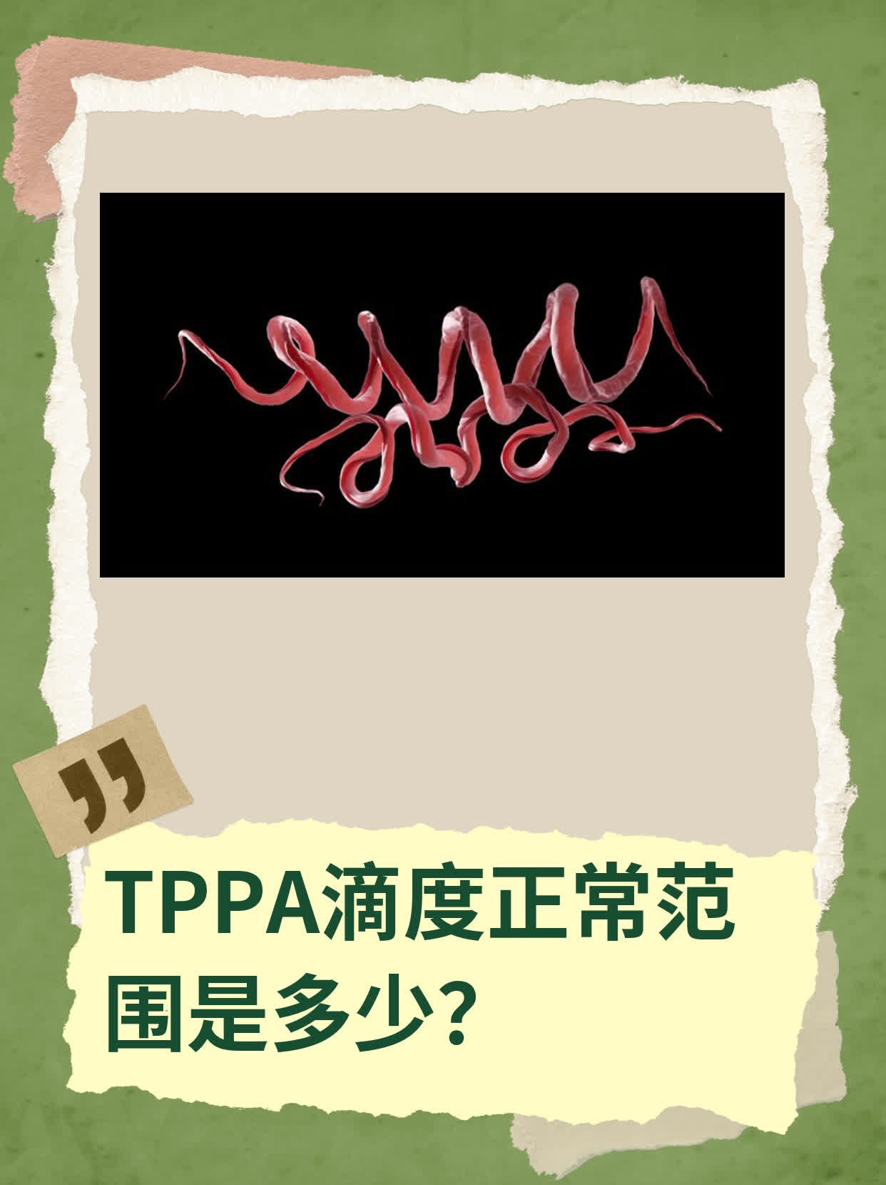 tppa滴度正常范围是多少