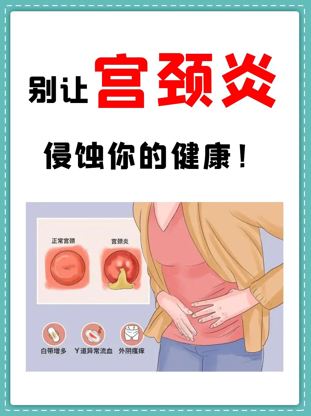 什么是宫颈炎?
