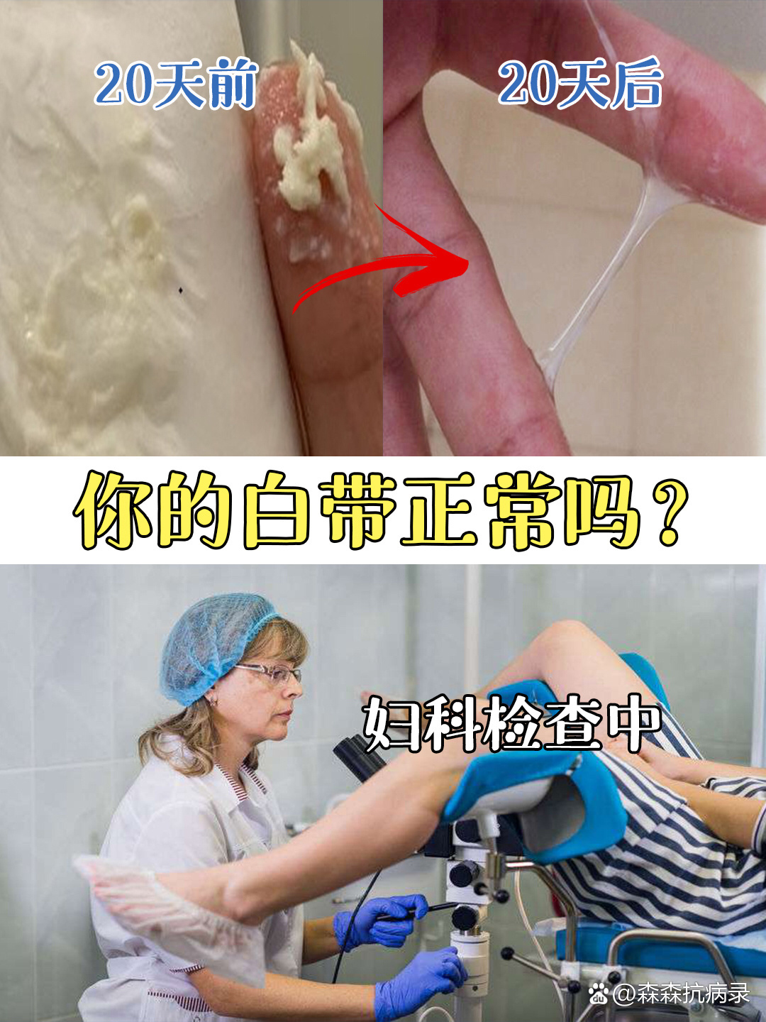 这样的白带你见过吗?
