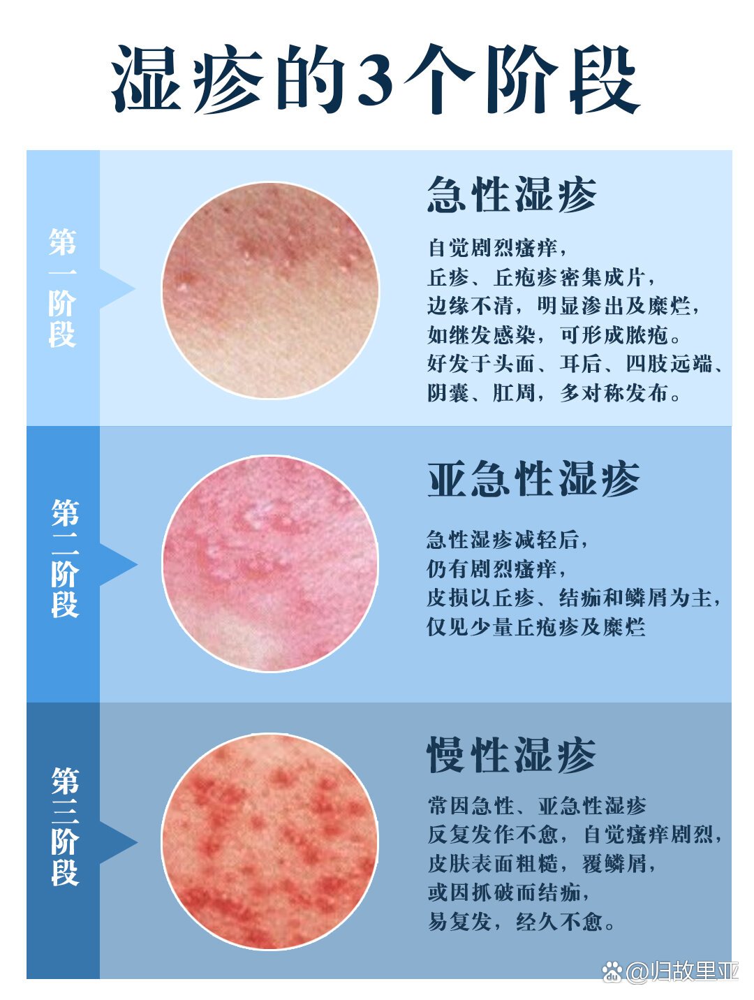 肛周发白图片