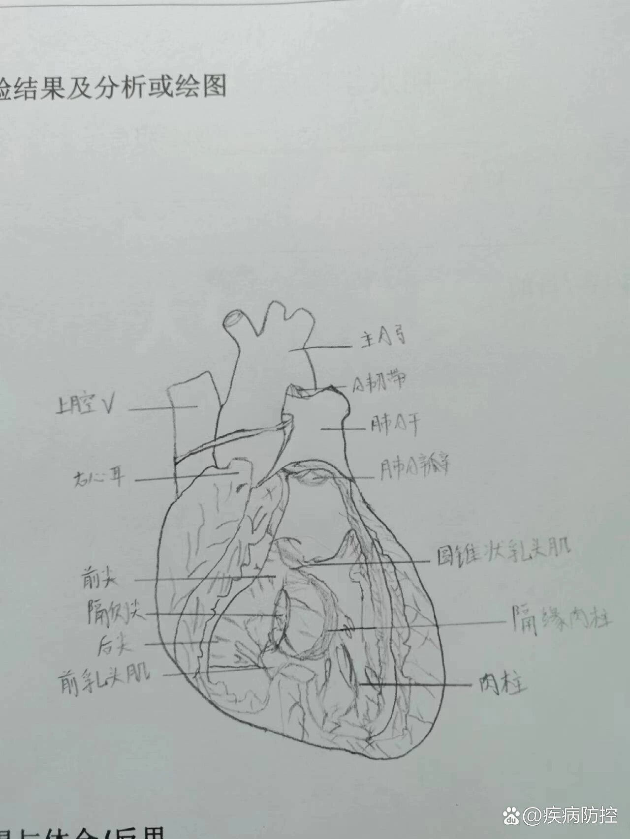 心壁切片手绘图图片