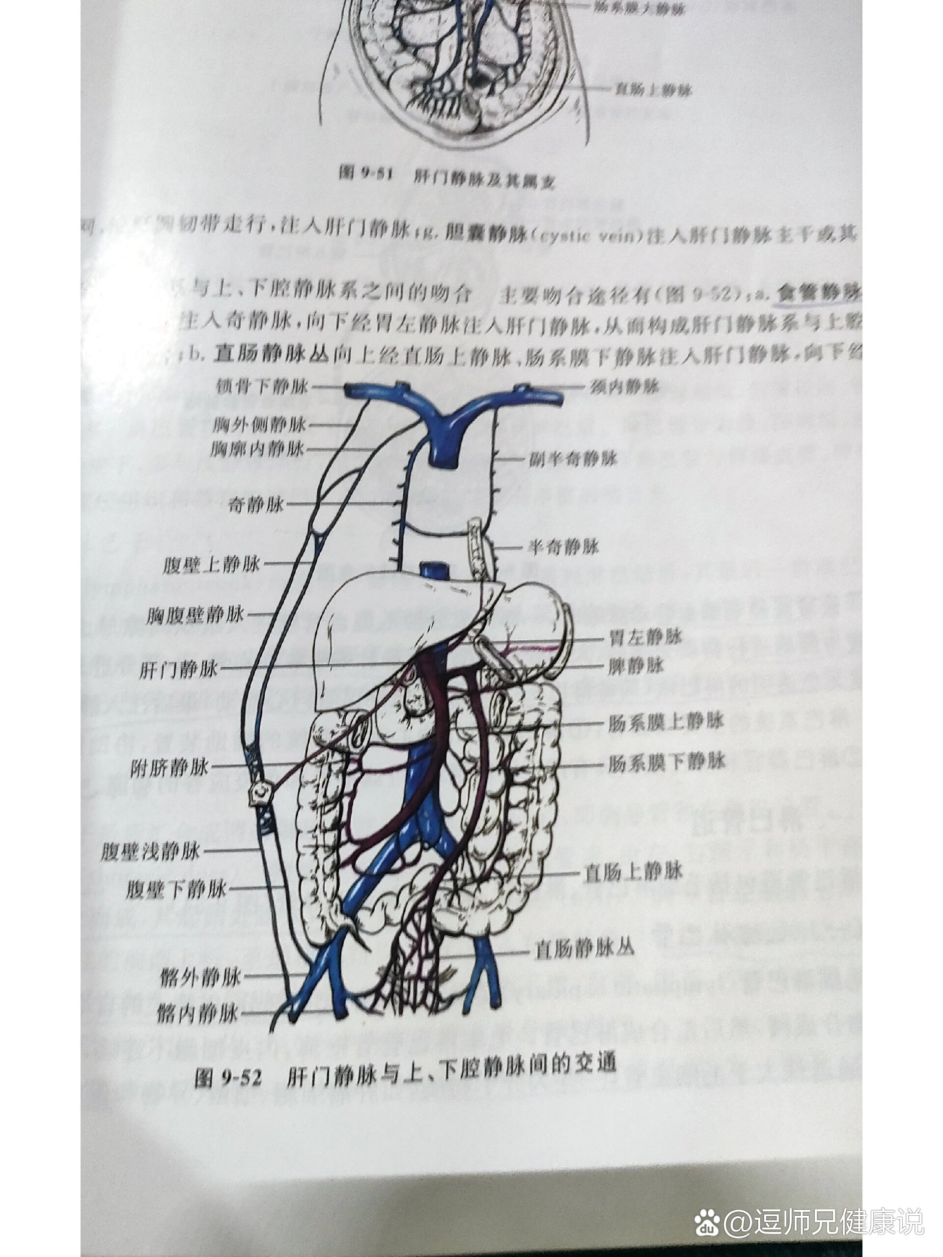 肝脏下腔静脉图片