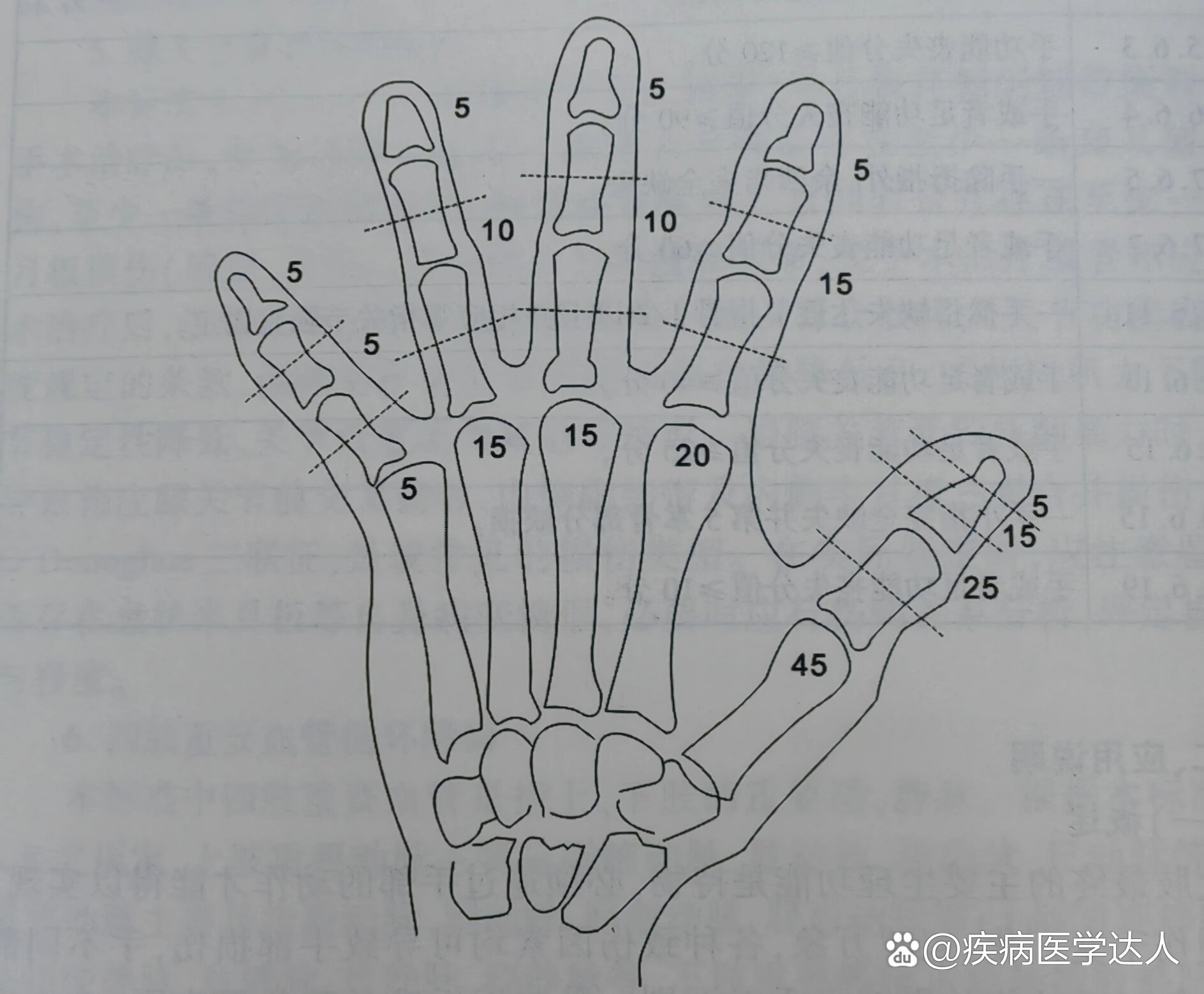 手功能分值图图片