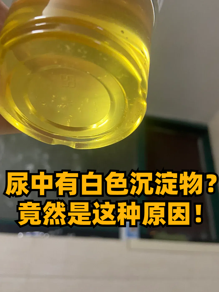 正常尿液有沉淀物吗图片