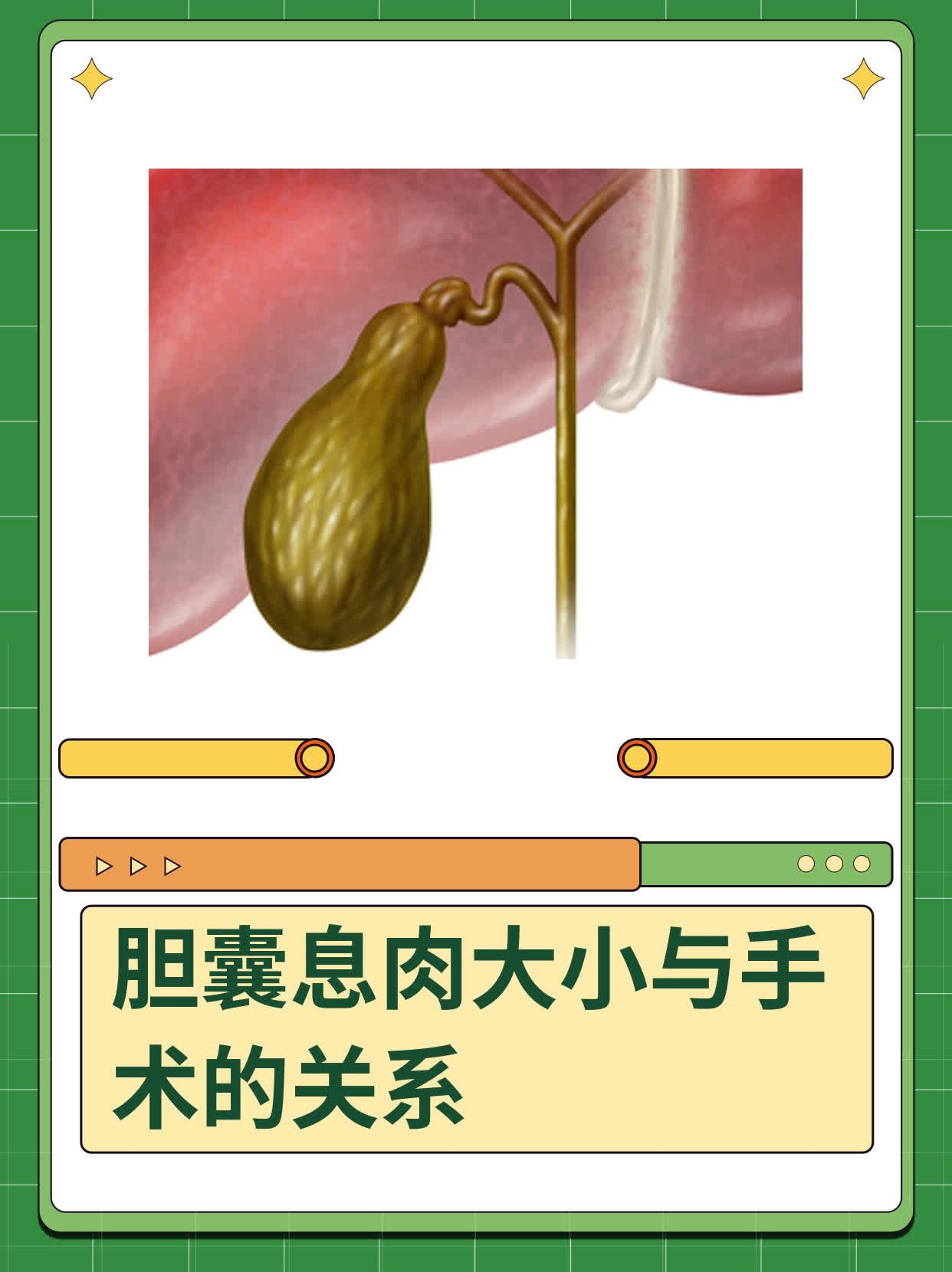 胆囊息肉大小与手术的关系