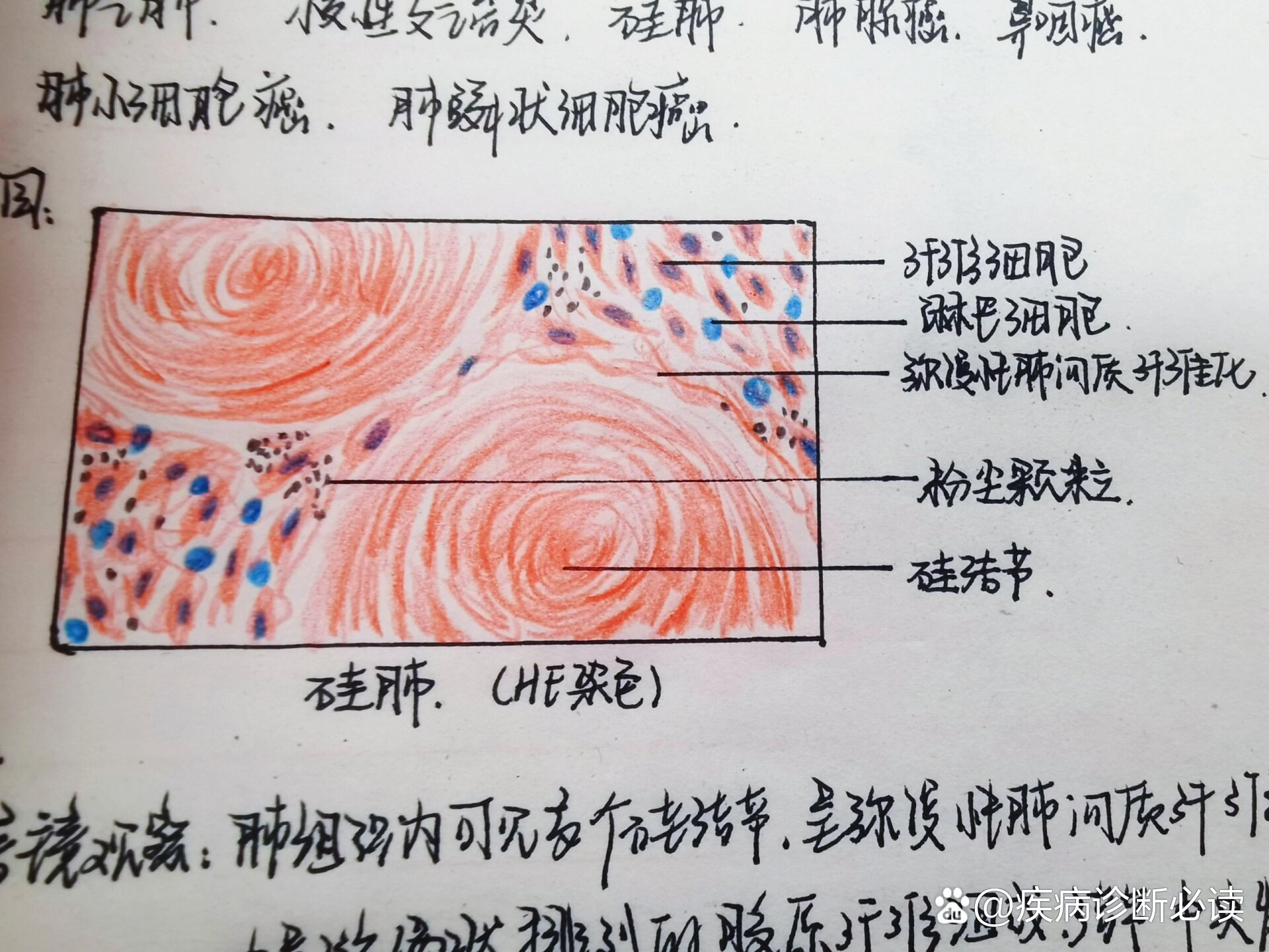 病理学实验红蓝铅笔绘图/实验报告(下篇)