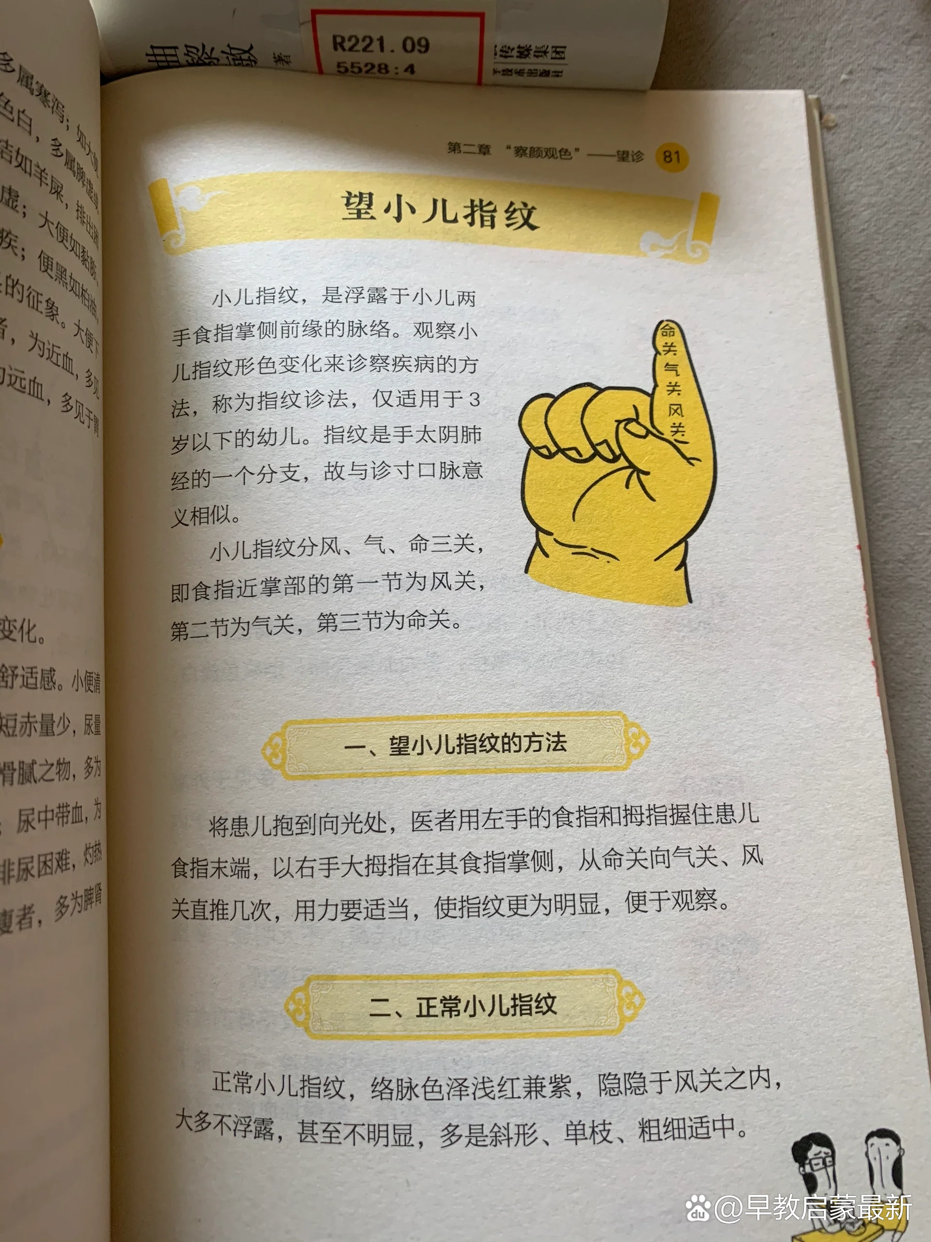  p>望小儿指纹三关,适用3岁内孩子 br>见图片,辅助诊断 /p>