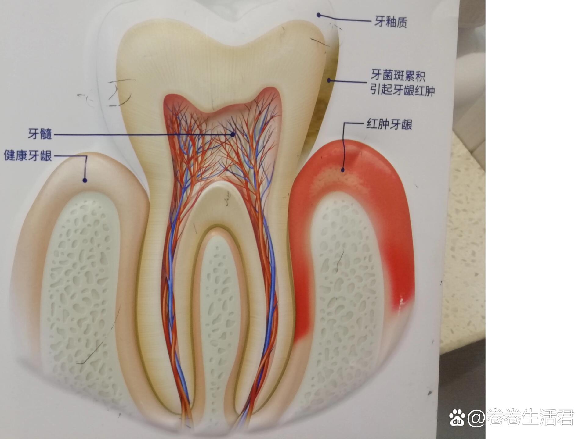 上齿龈根部位置图图片