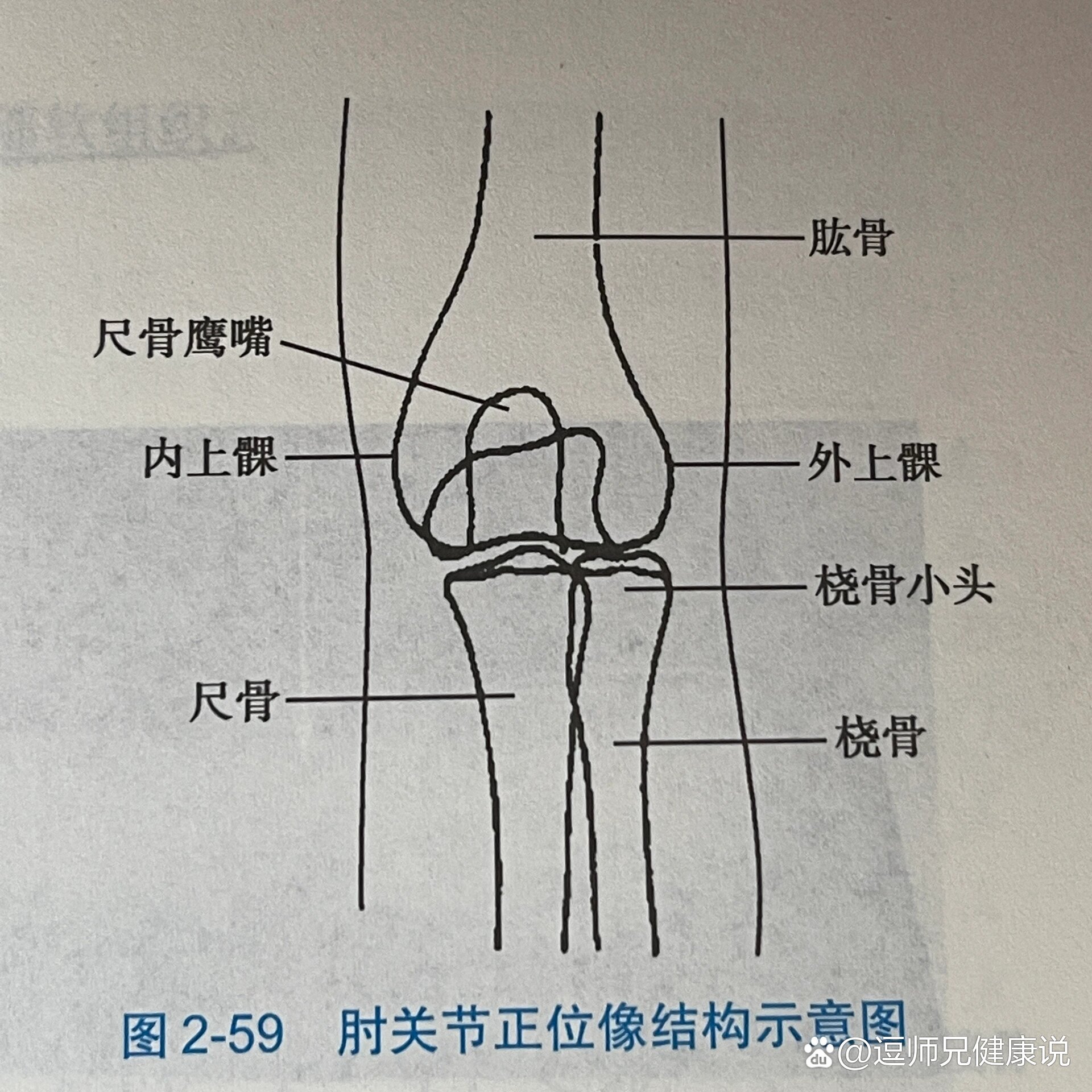 肘关节拍片正常图图片