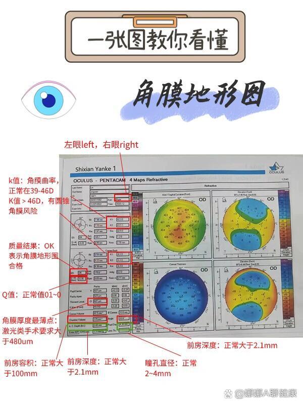 常见角膜地形图图片