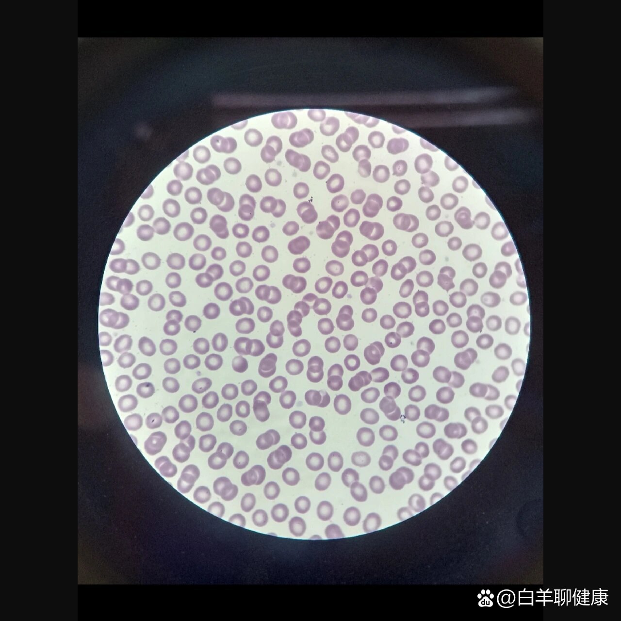 一些红细胞和白细胞