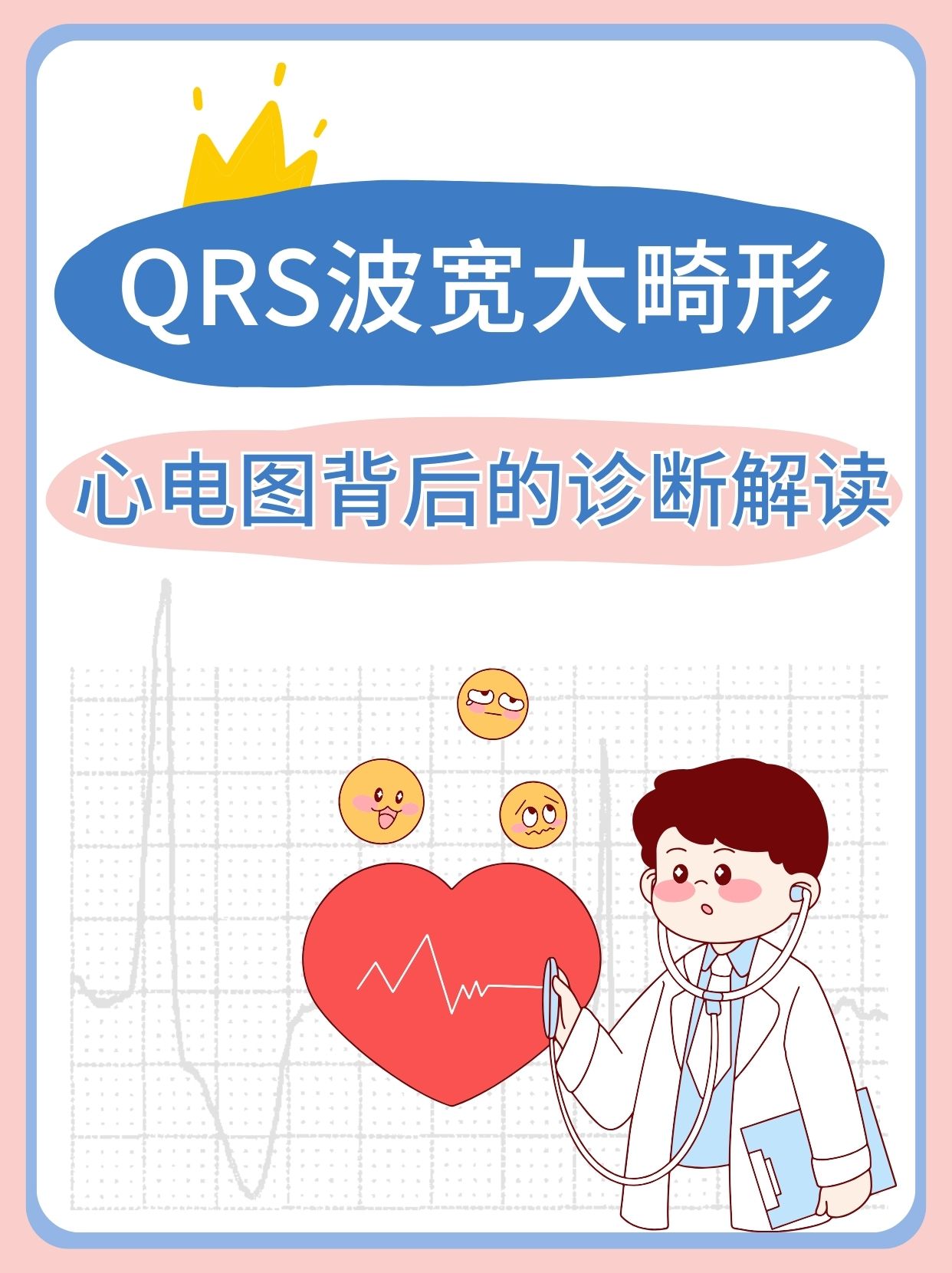 qrs波宽大畸形:心电图背后的诊断解读