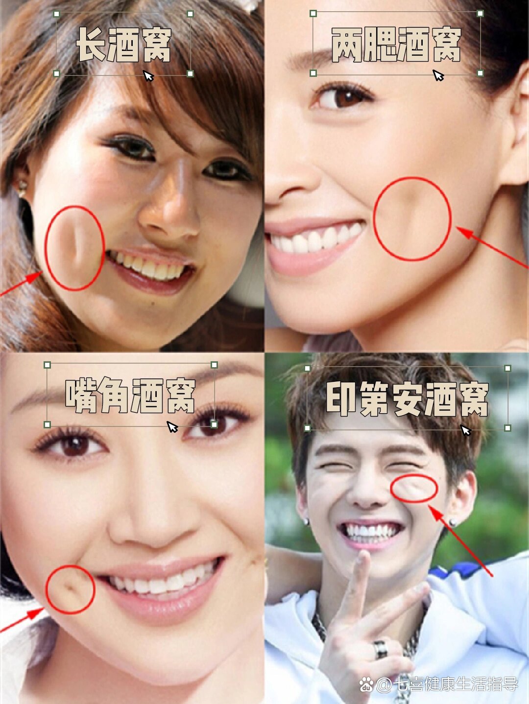 酒窝还分类型?