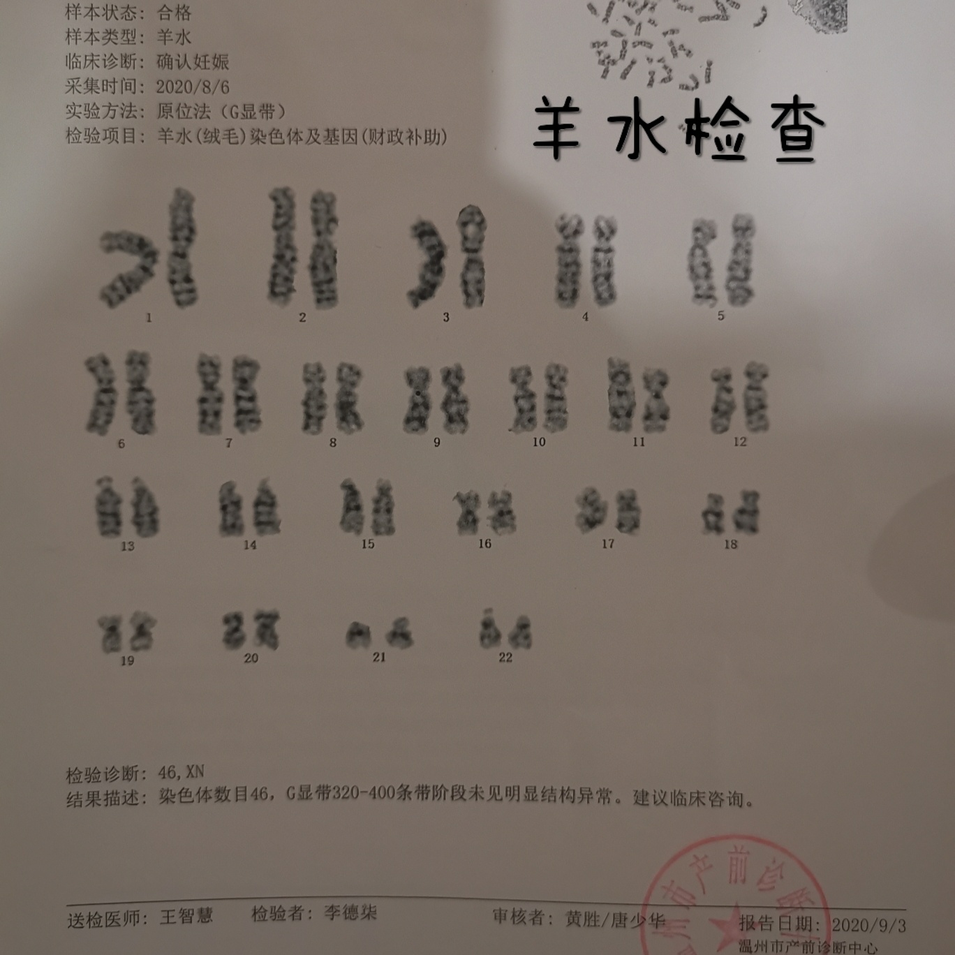 唐筛21三体1:5高风险!