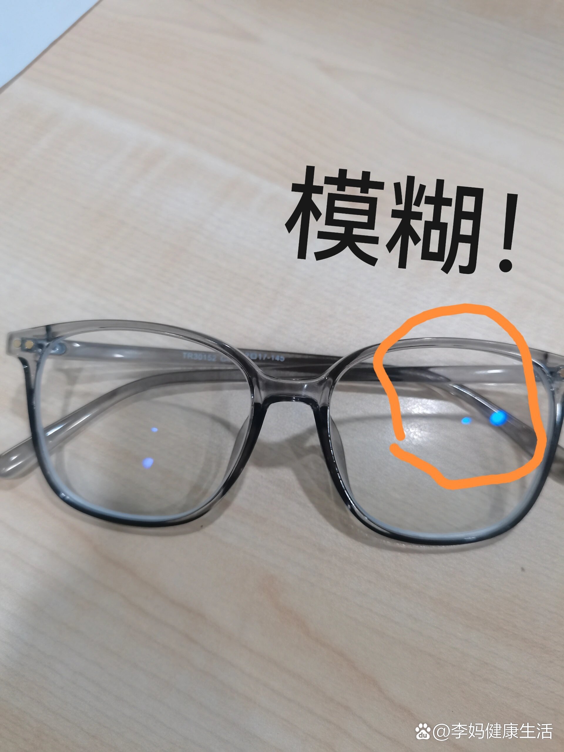 眼镜一只眼清晰一只眼模糊