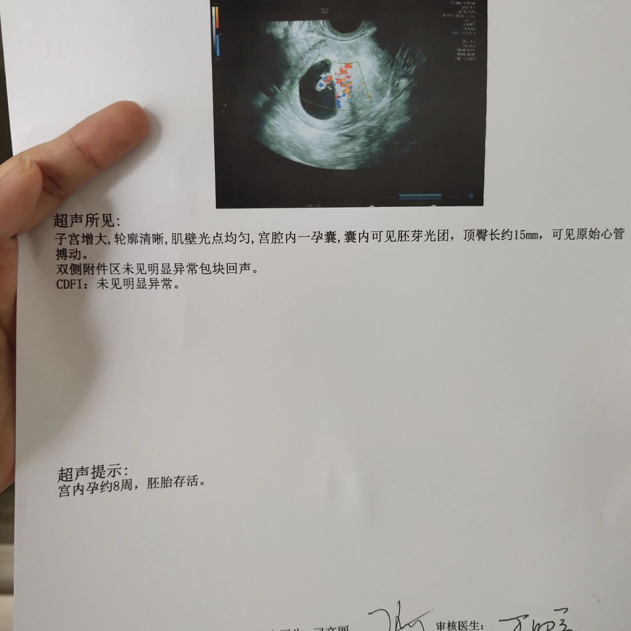 孕8周