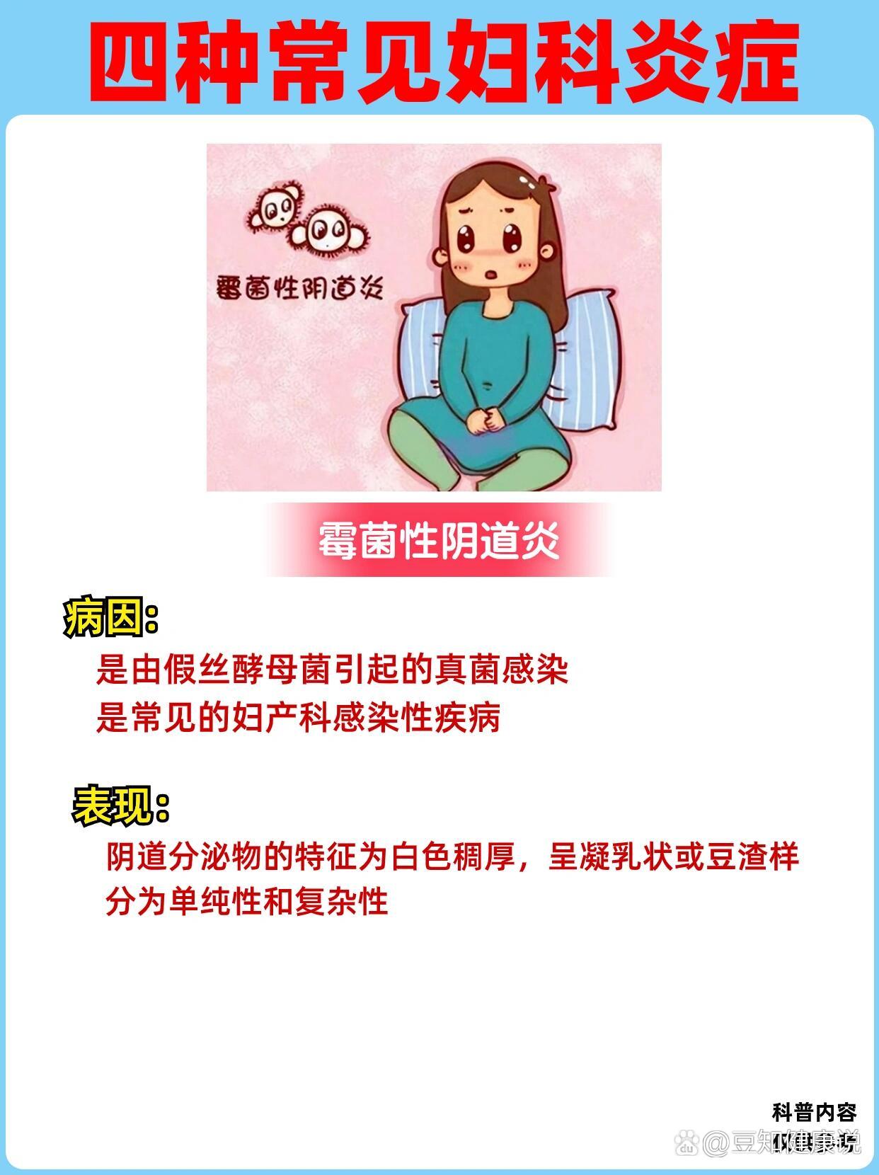 常见20种妇科病图片图片