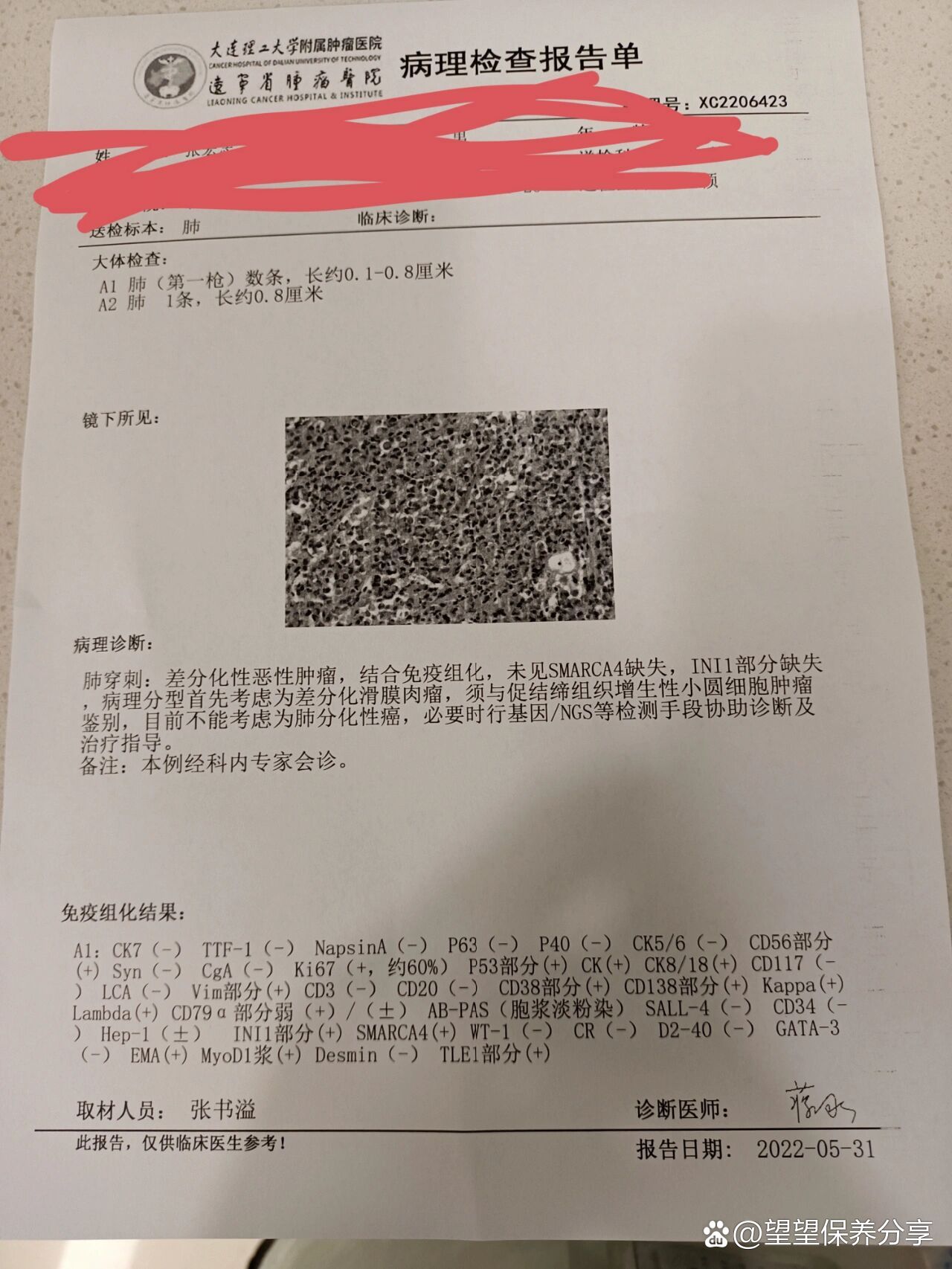后来腰疼,我带他去地方医院检查说是肺癌晚期.