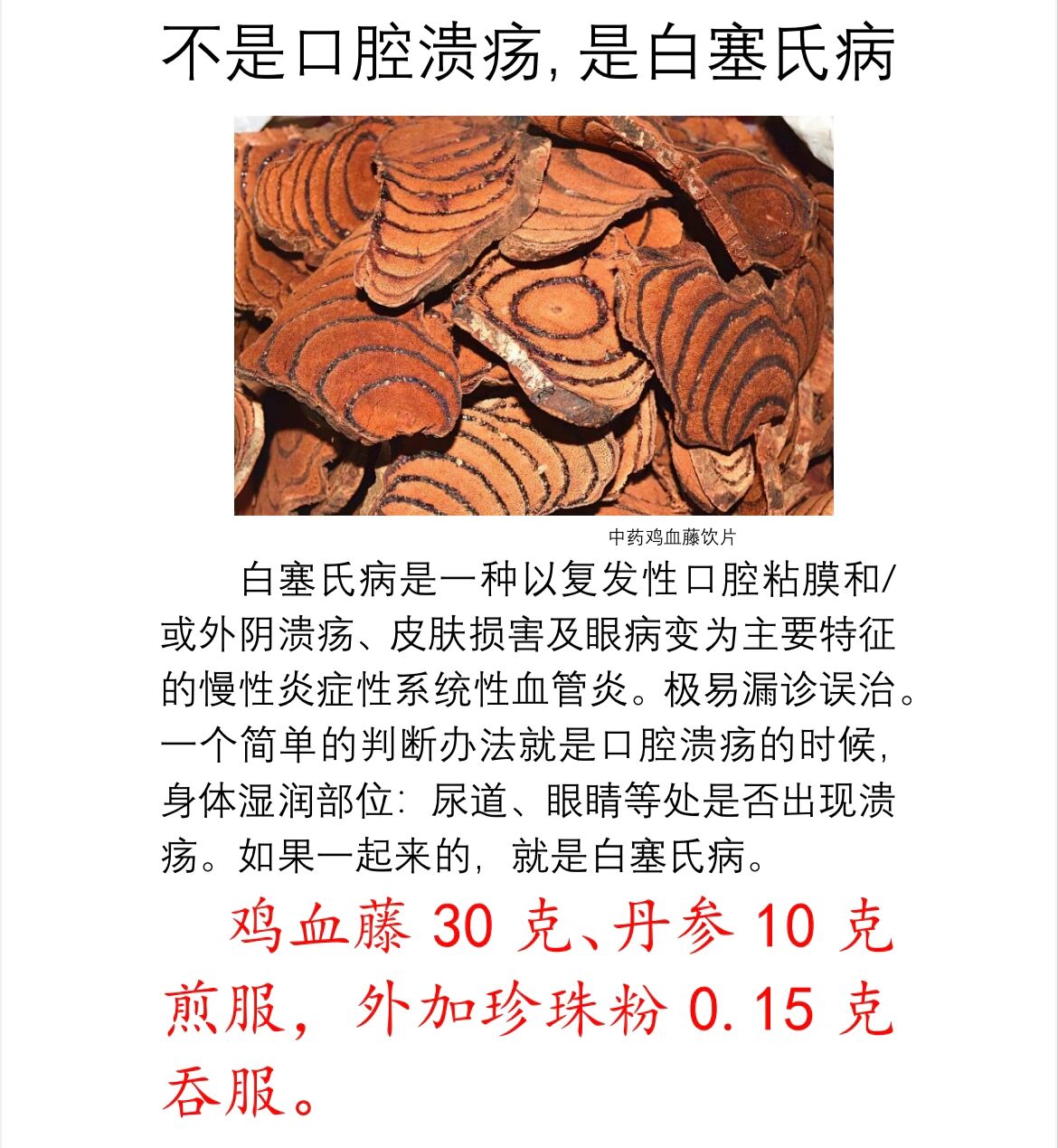 一种极像口腔溃疡的病:白塞氏病