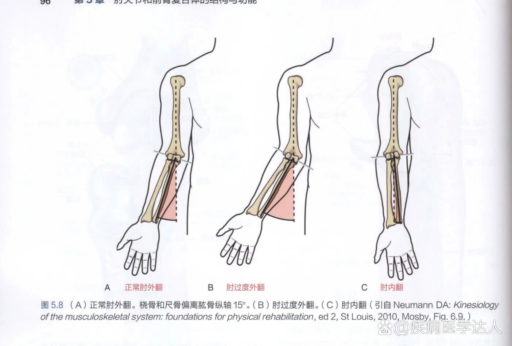 胳膊肘往外拐图片图片