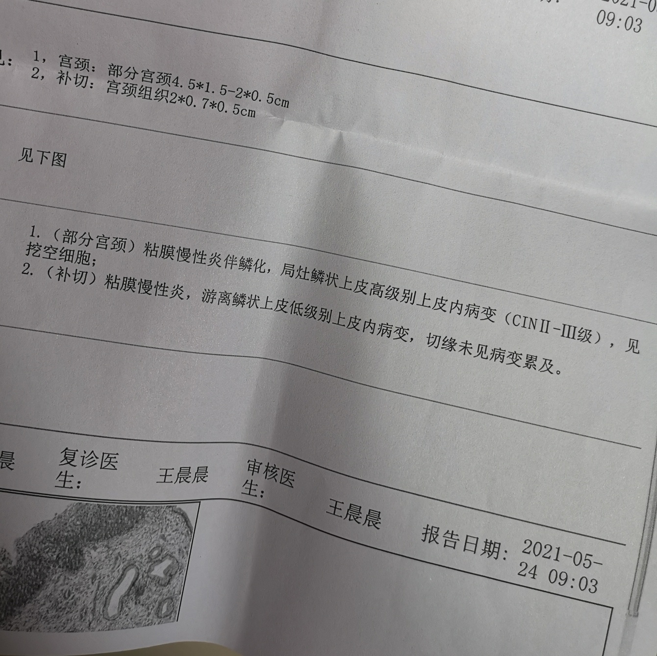 leep刀手术的病理结果出来啦!